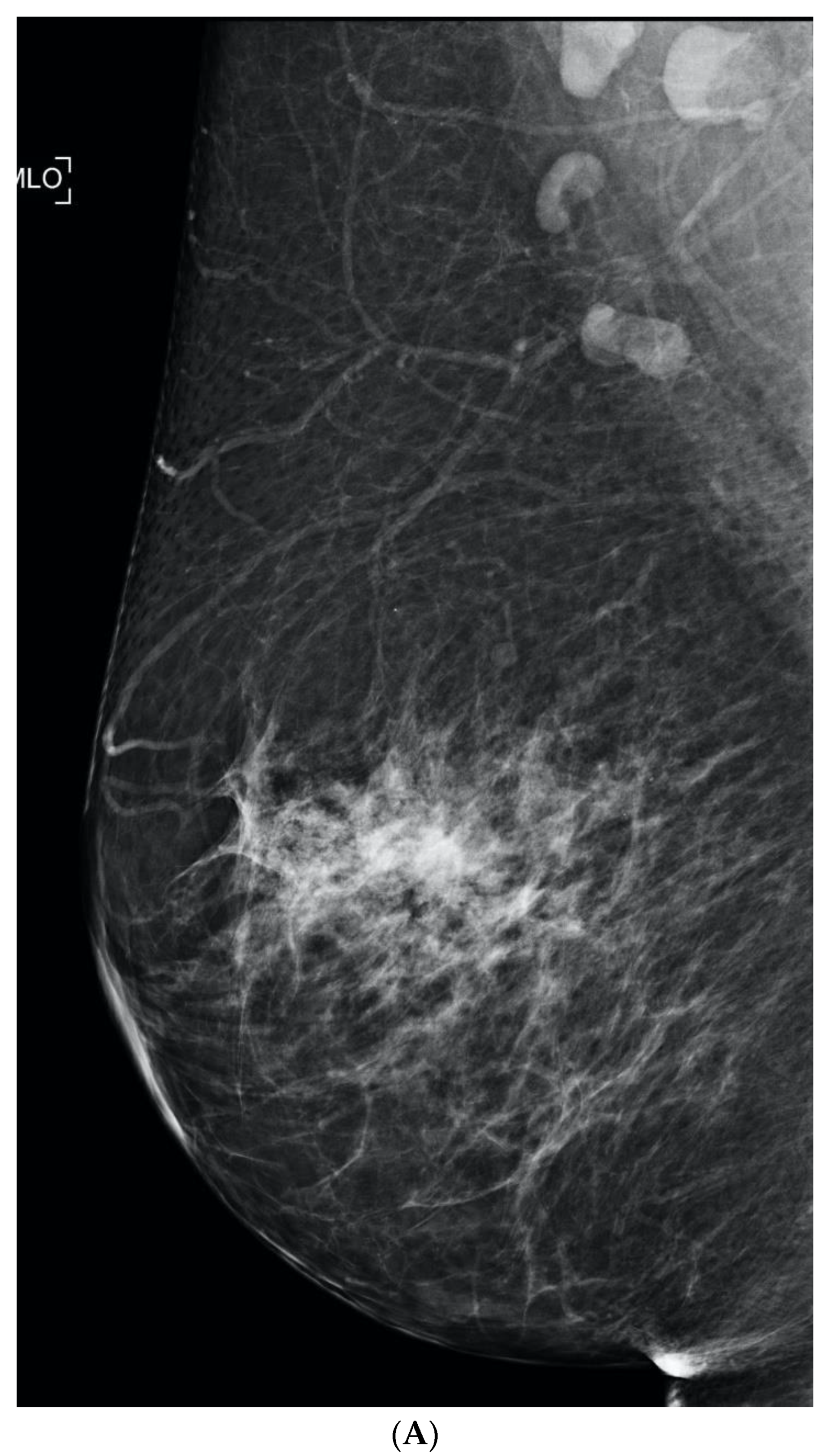 Curroncol 29 00291 g005a Curroncol 29 00291 g005a