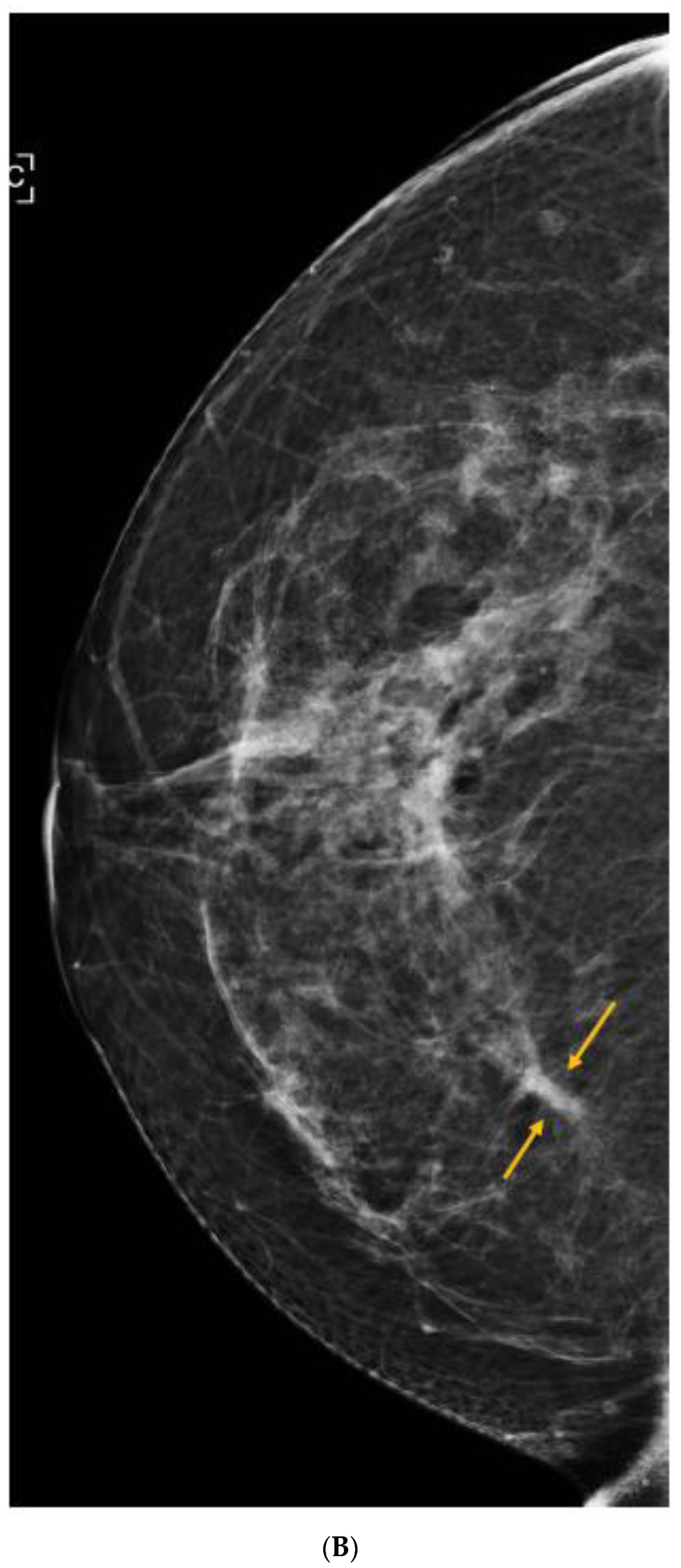 Curroncol 29 00291 g005b Curroncol 29 00291 g005b