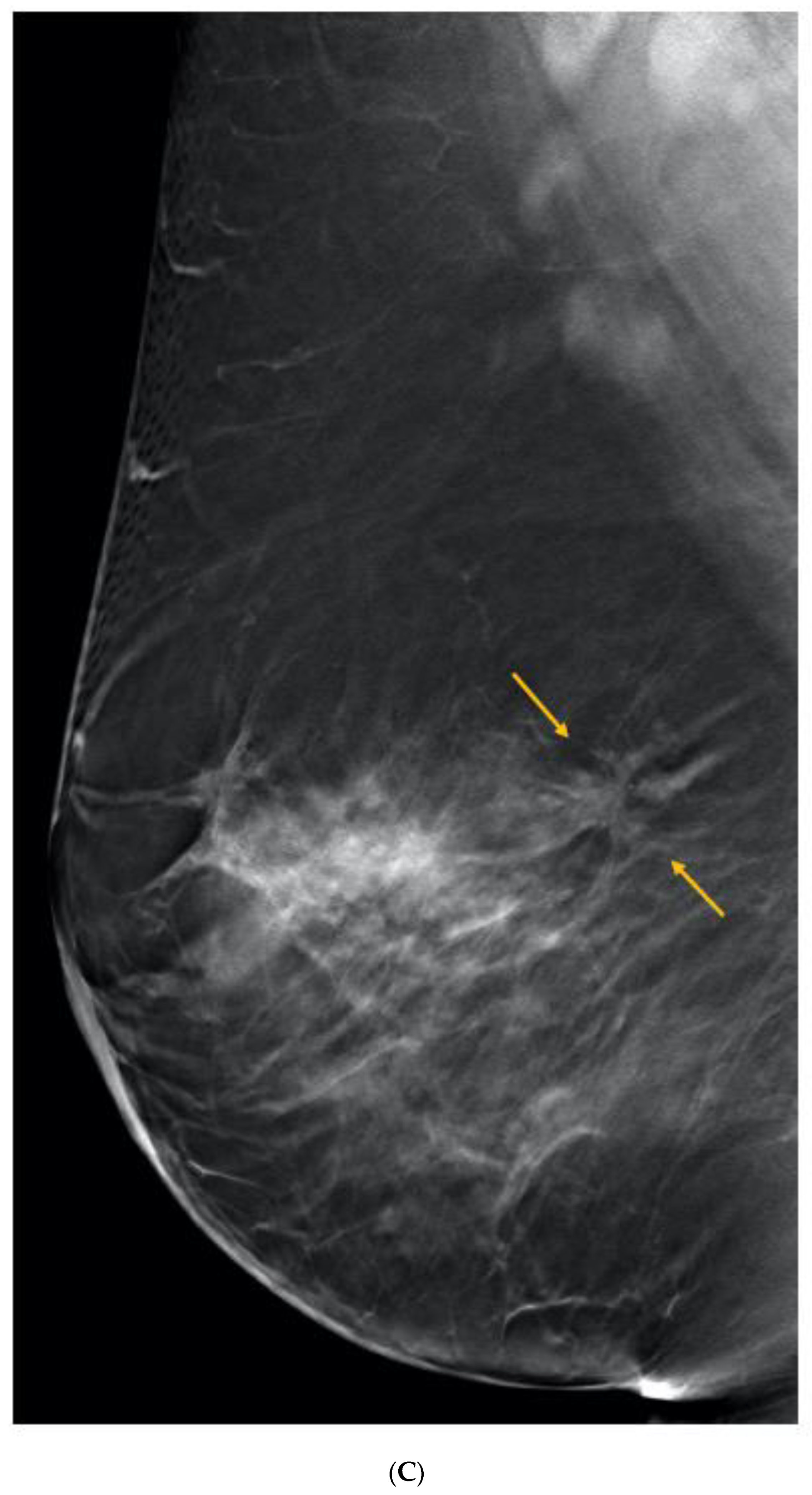 Curroncol 29 00291 g005c Curroncol 29 00291 g005c