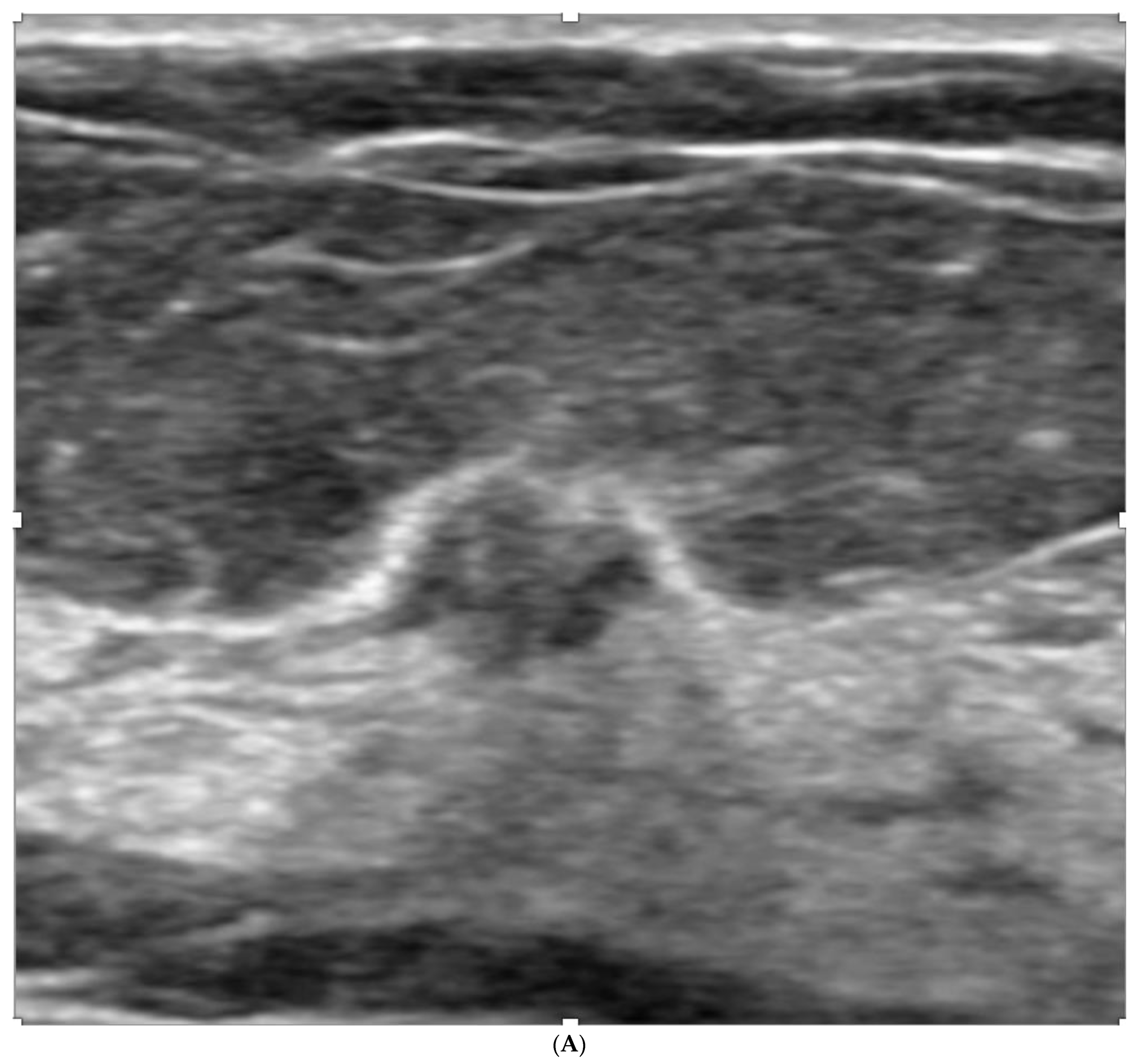 Curroncol 29 00291 g006a Curroncol 29 00291 g006a