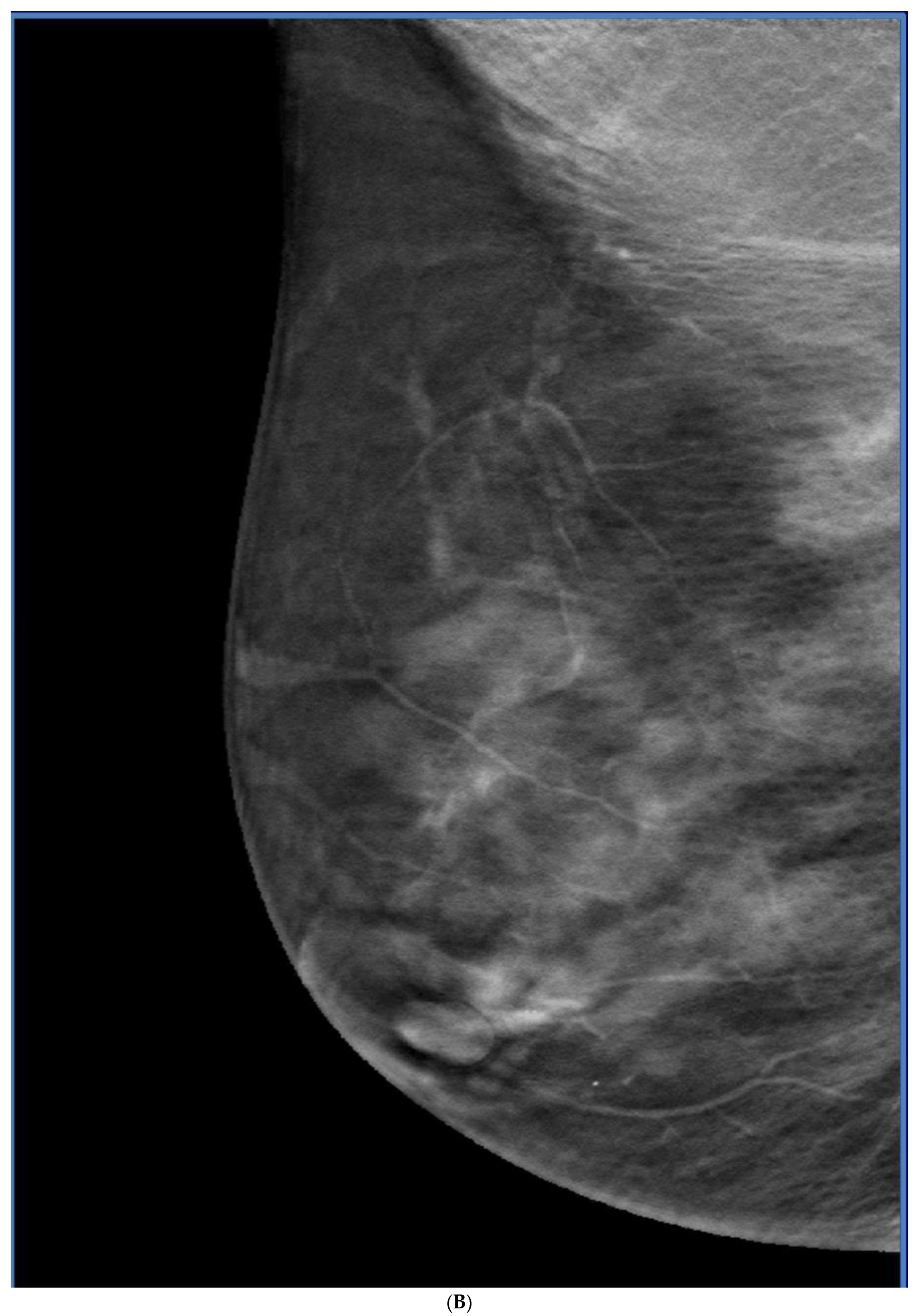 Curroncol 29 00291 g006b Curroncol 29 00291 g006b