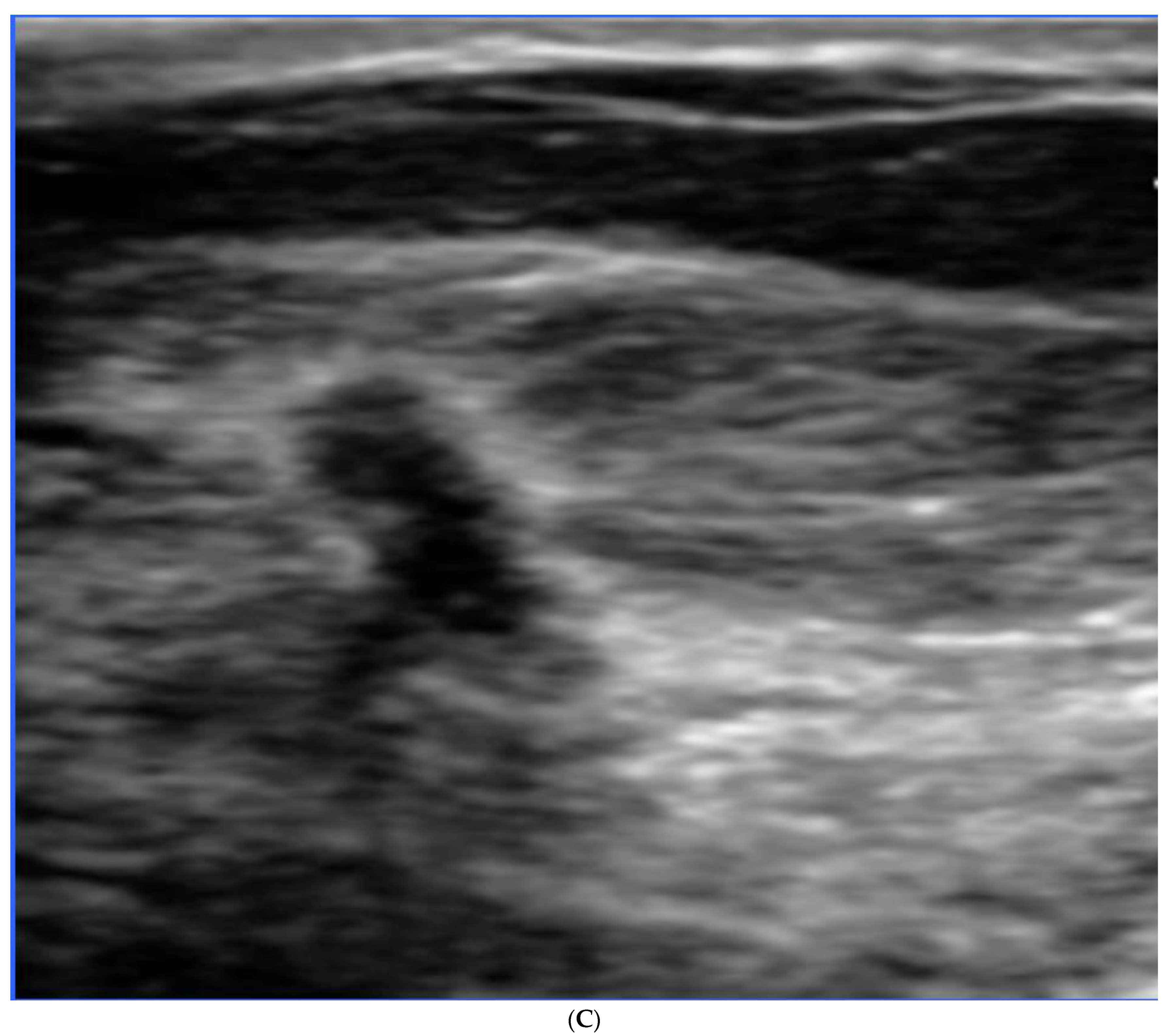 Curroncol 29 00291 g006c Curroncol 29 00291 g006c