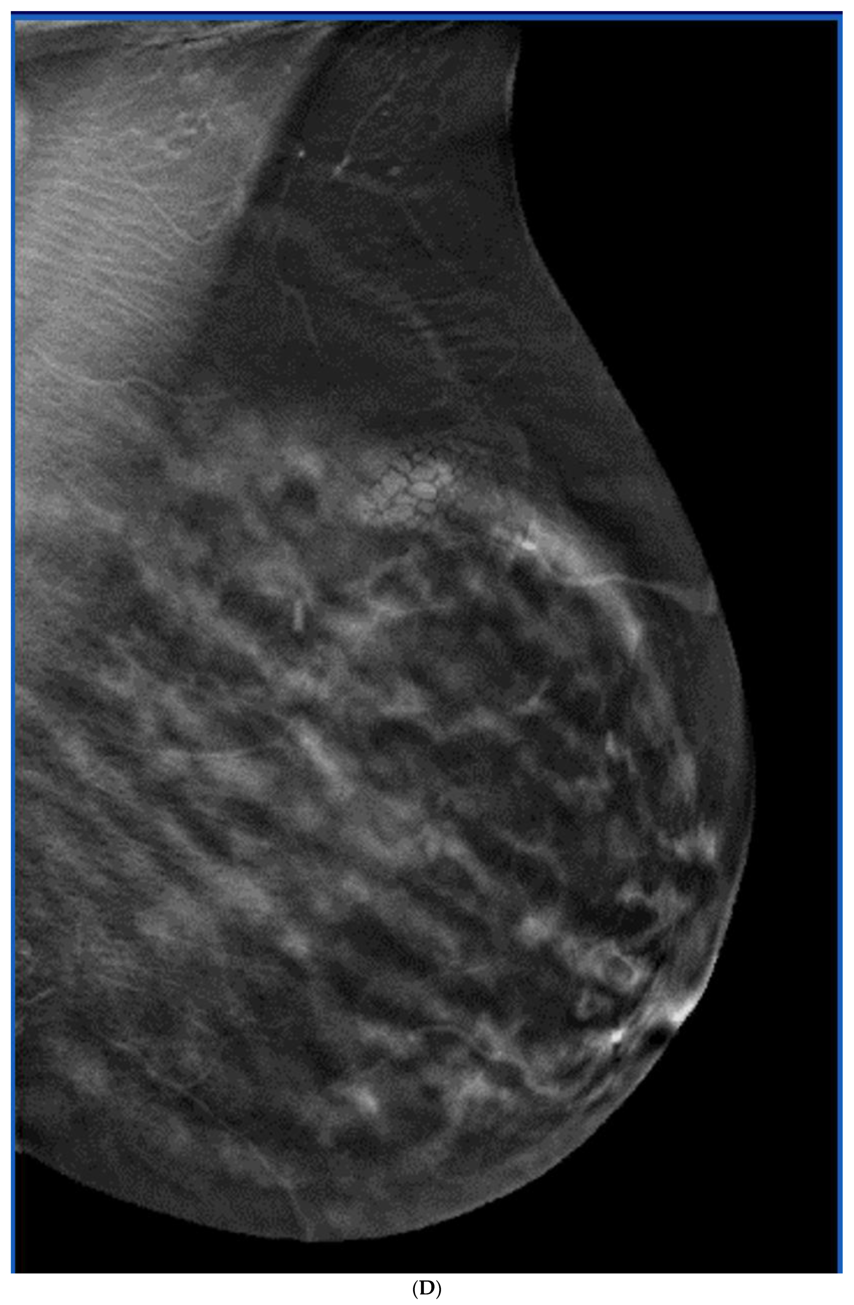 Curroncol 29 00291 g006d Curroncol 29 00291 g006d