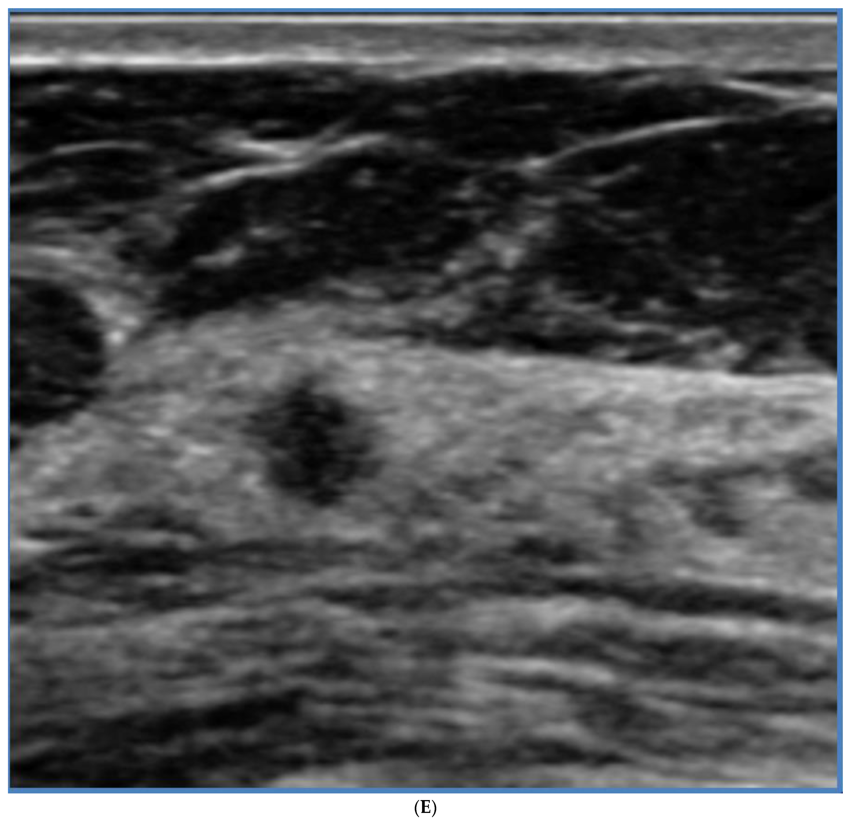 Curroncol 29 00291 g006e Curroncol 29 00291 g006e