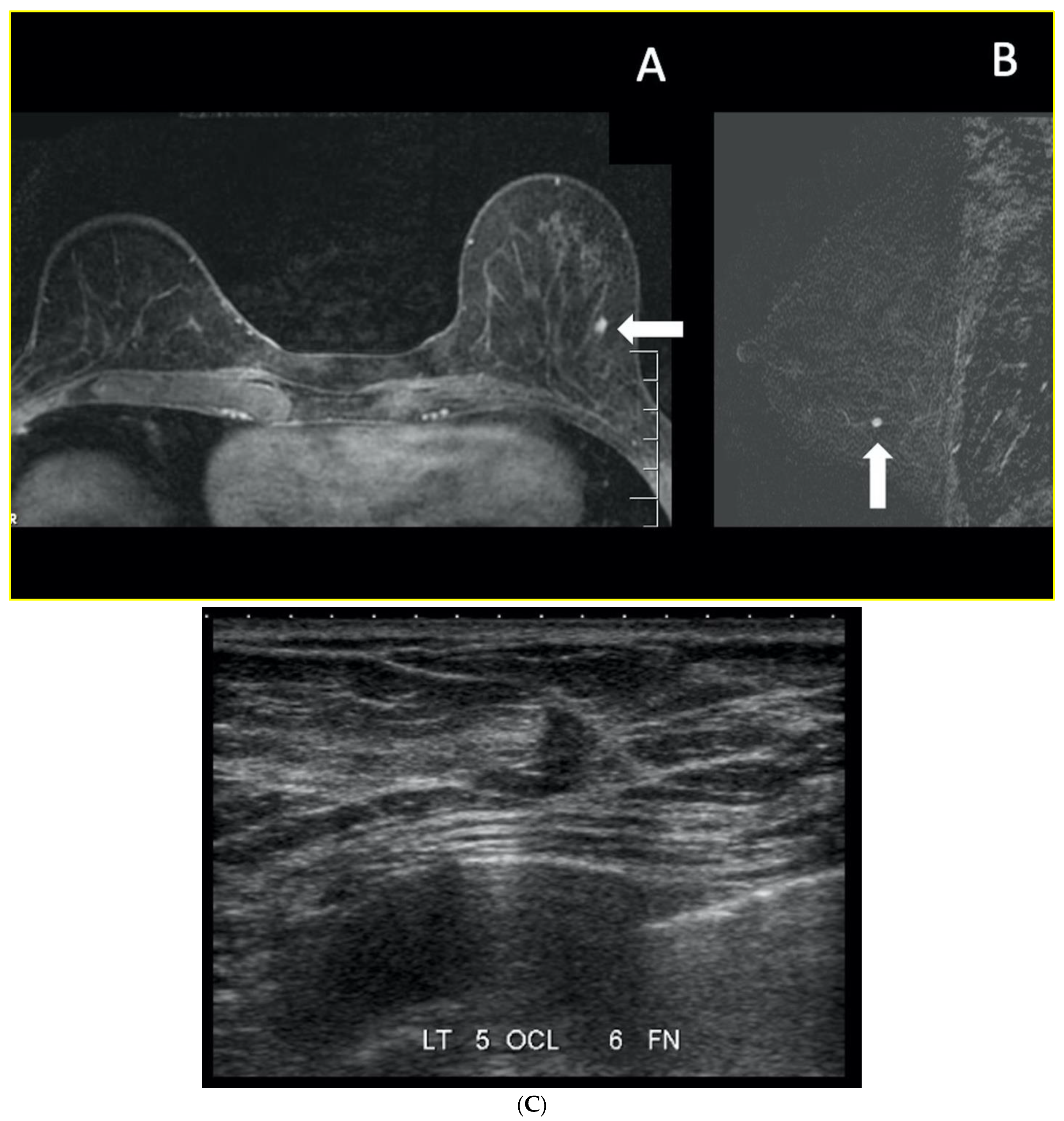 Curroncol 29 00291 g007 Curroncol 29 00291 g007