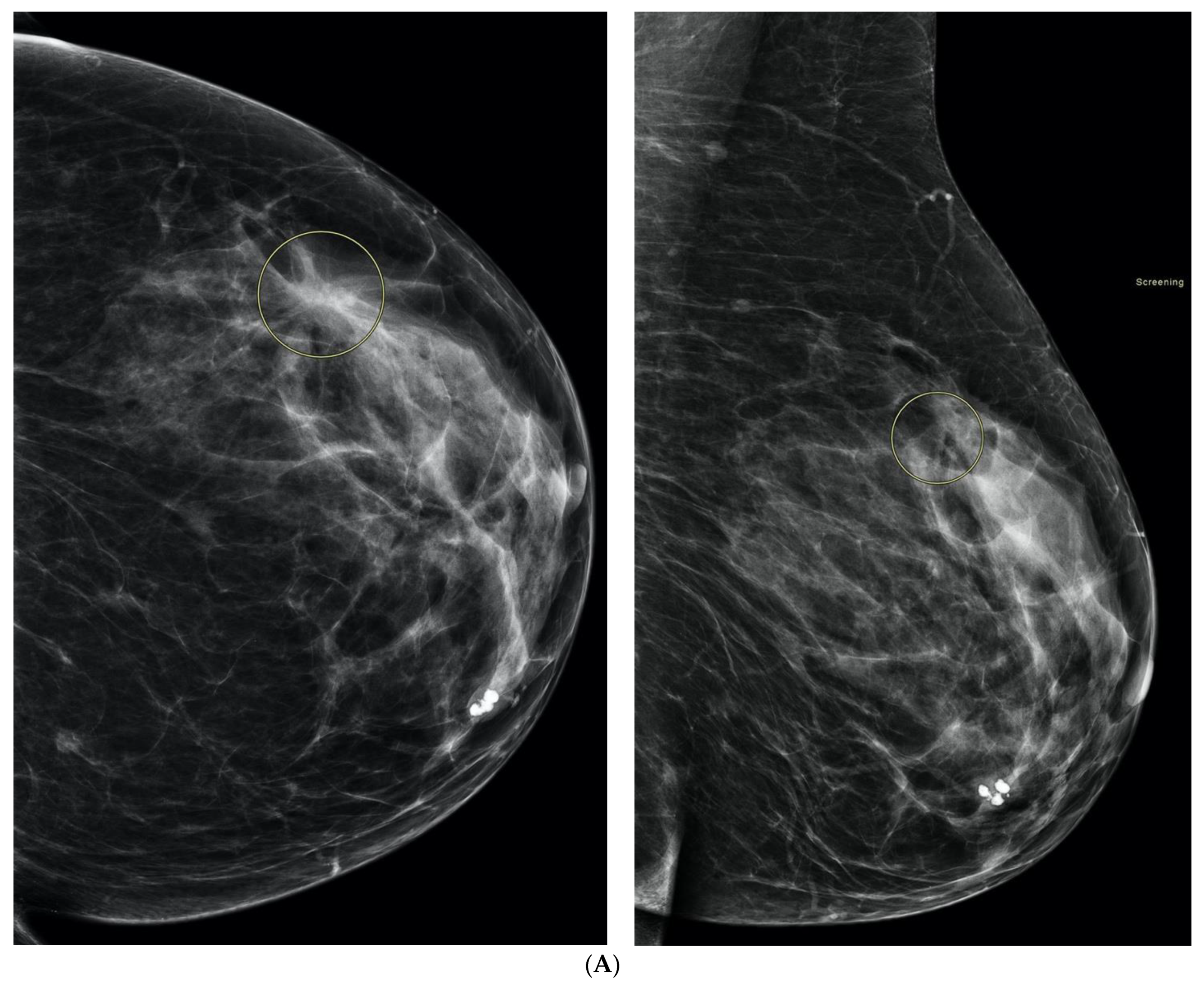 Curroncol 29 00291 g008a Curroncol 29 00291 g008a