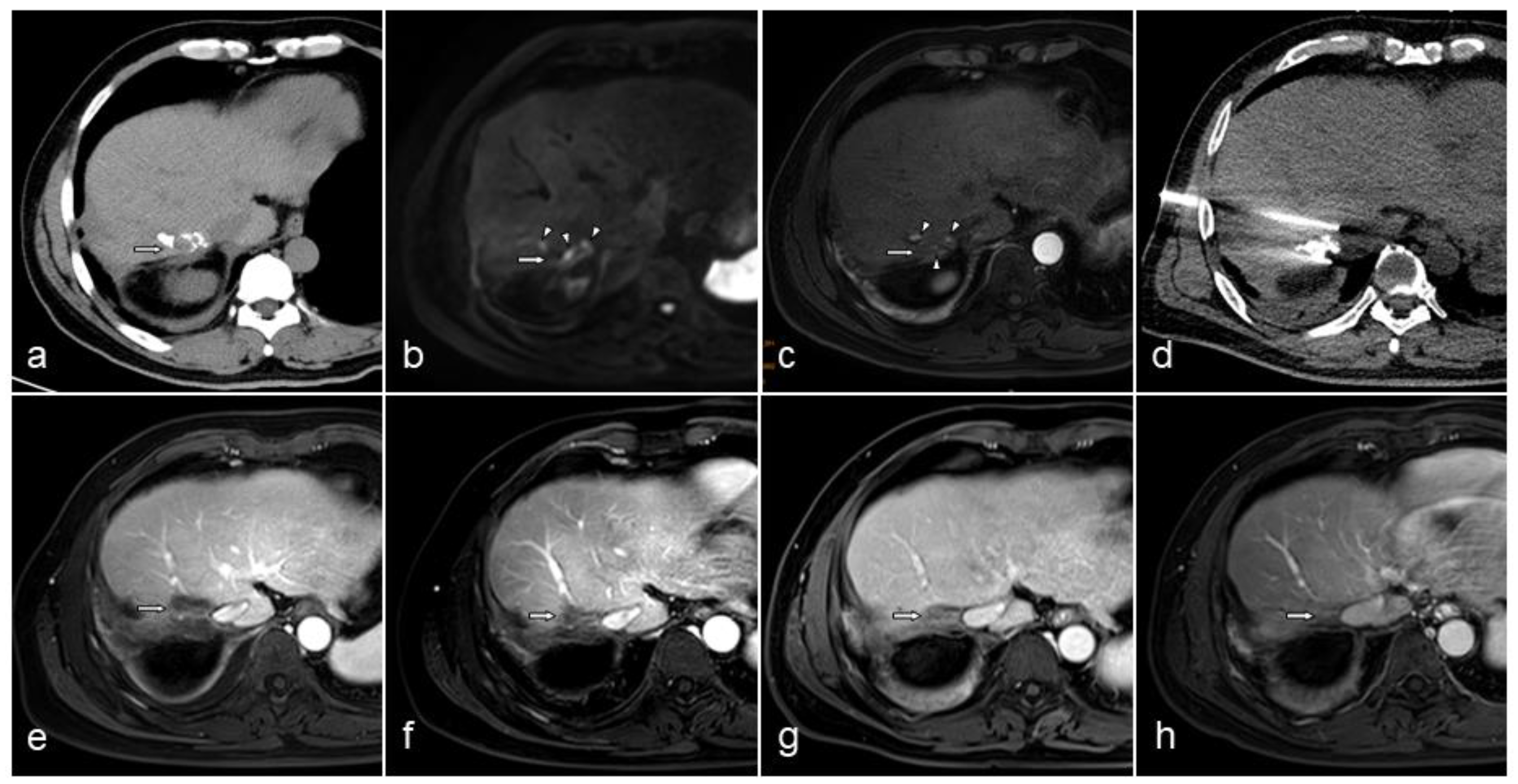 Curroncol 29 00316 g001