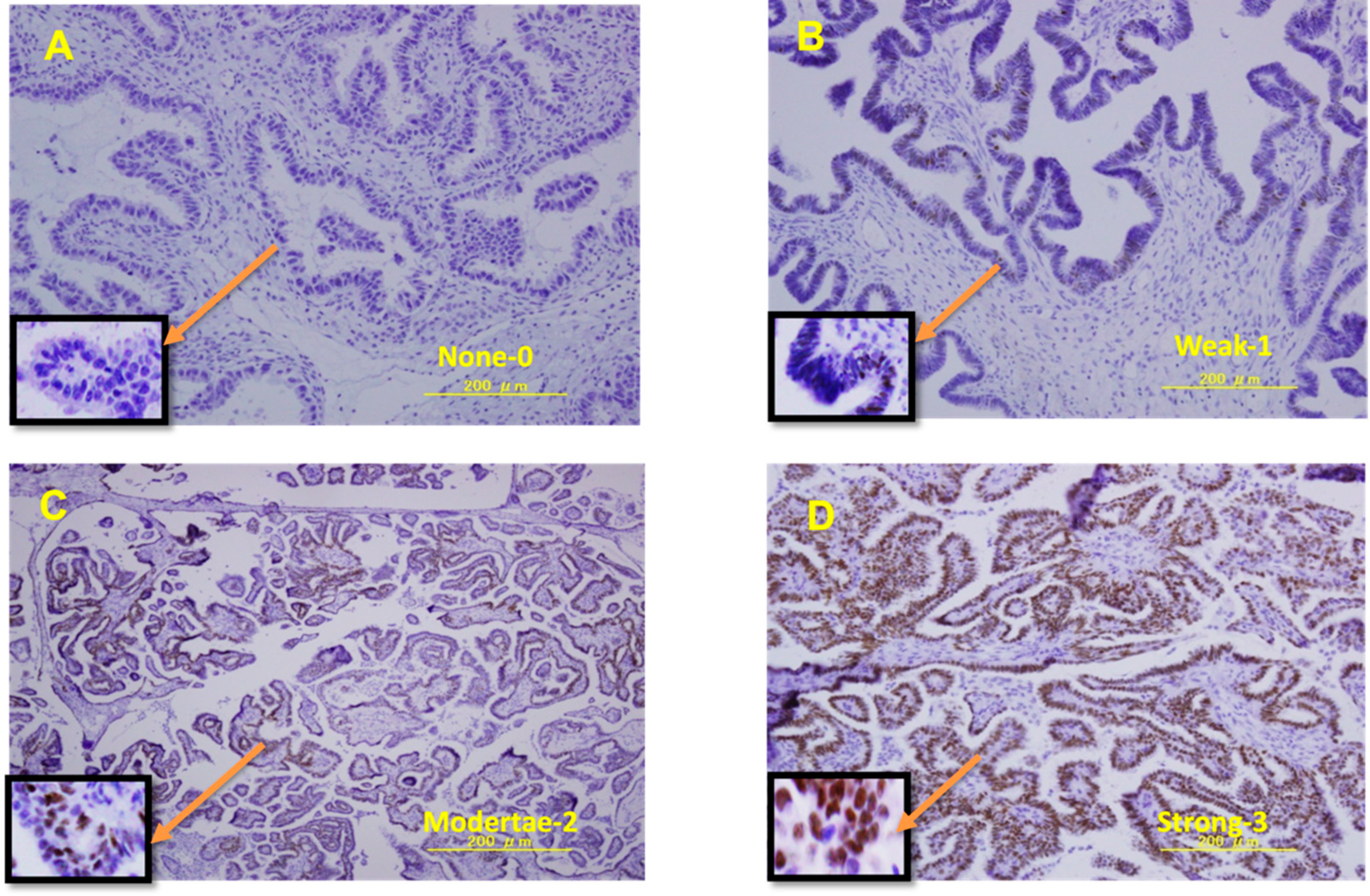 Curroncol 29 00321 g001 Curroncol 29 00321 g001