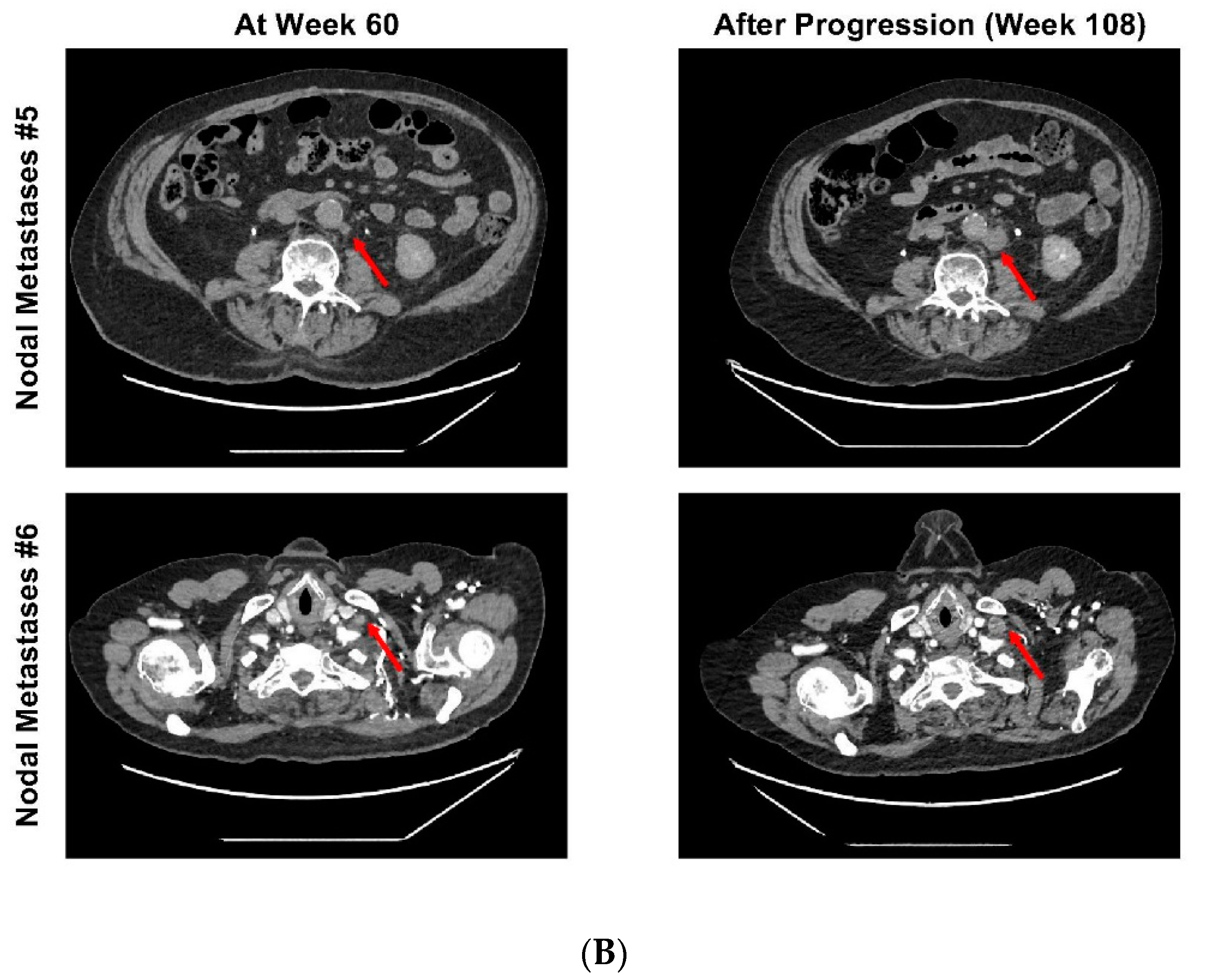 Curroncol 29 00333 g002b