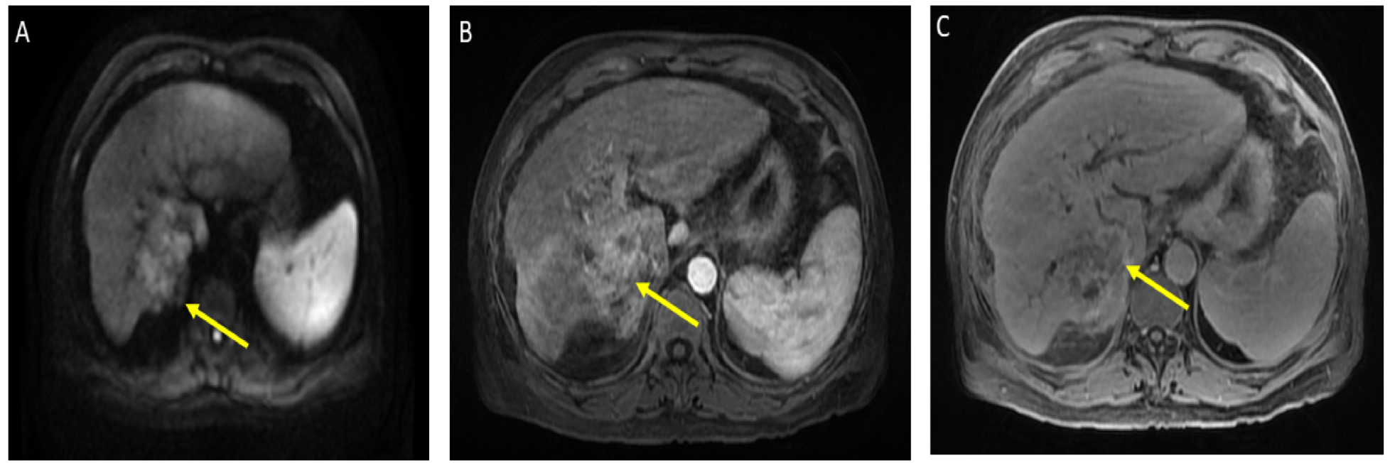 Curroncol 29 00341 g001 550