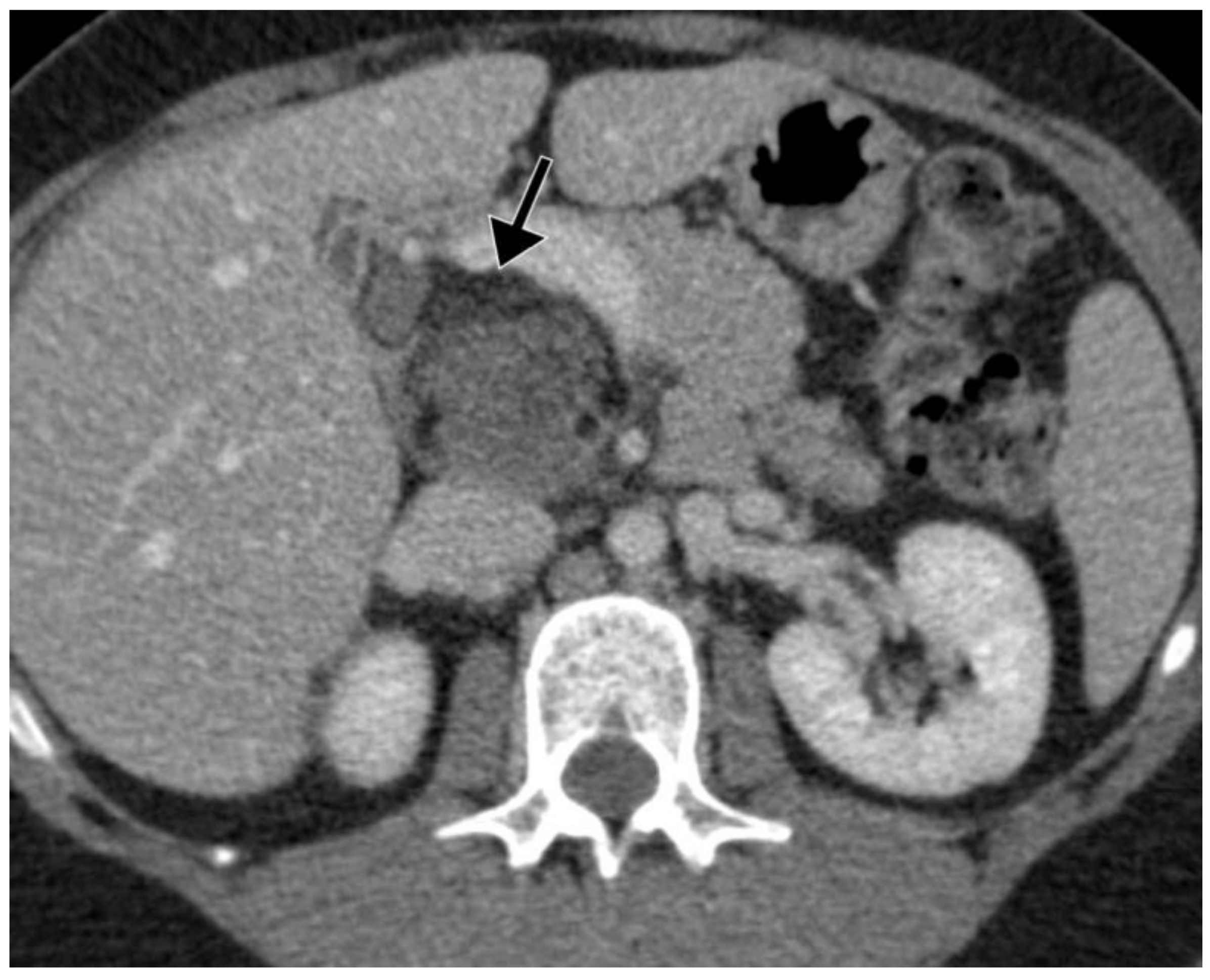 Curroncol 29 00374 g001 Curroncol 29 00374 g001