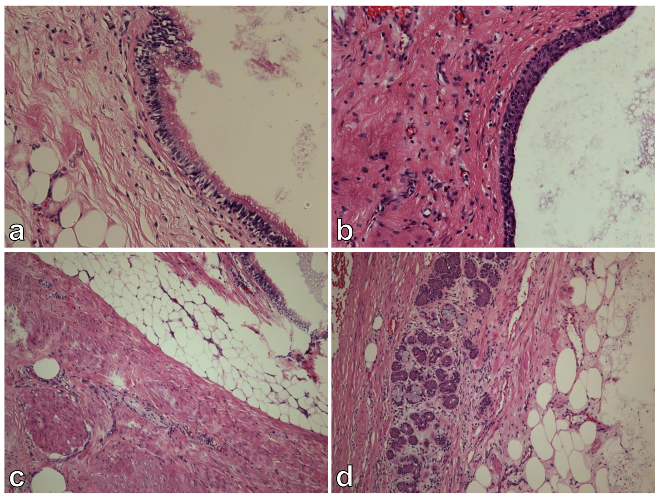 Curroncol 29 00374 g004 Curroncol 29 00374 g004