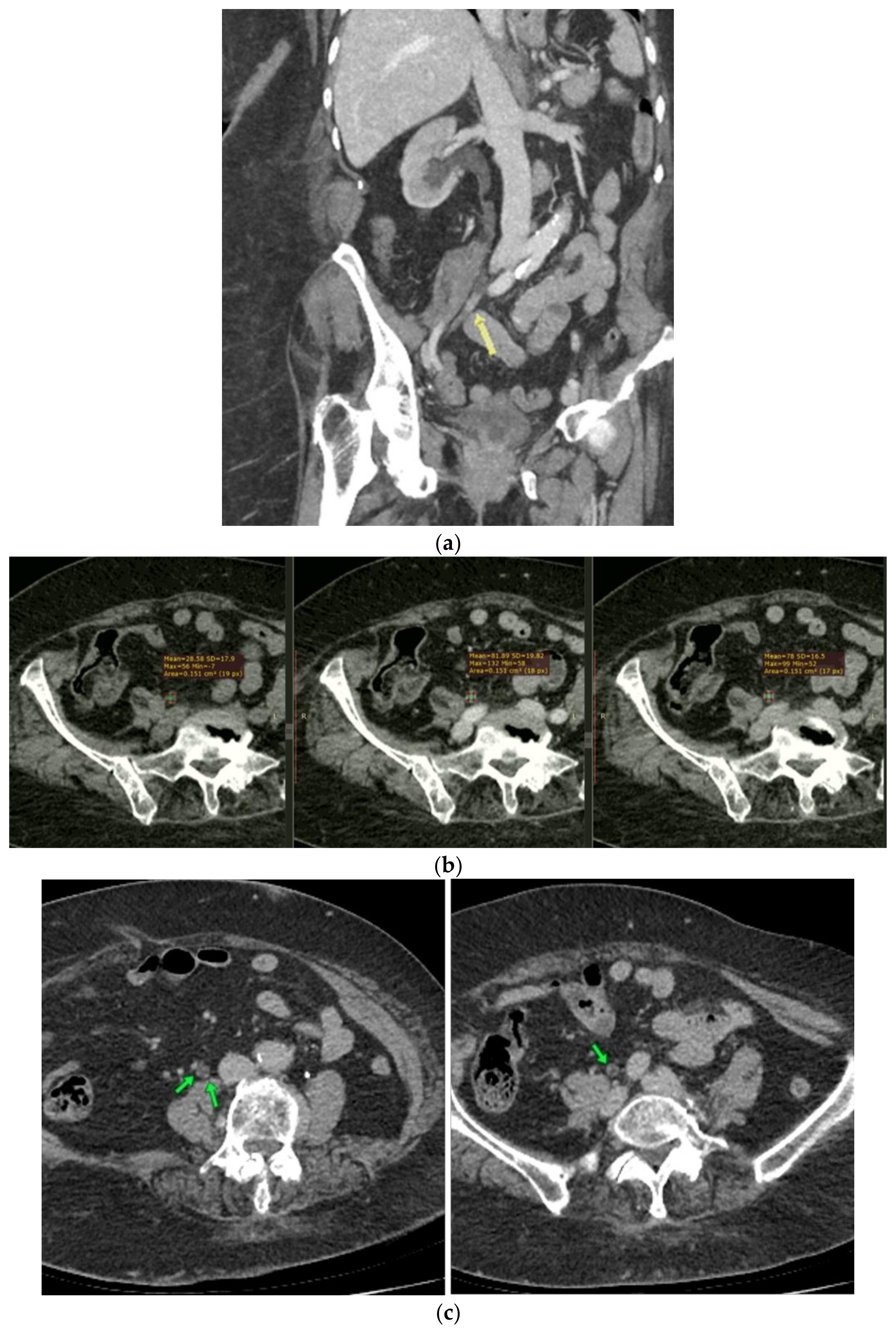 Curroncol 29 00380 g002 Curroncol 29 00380 g002