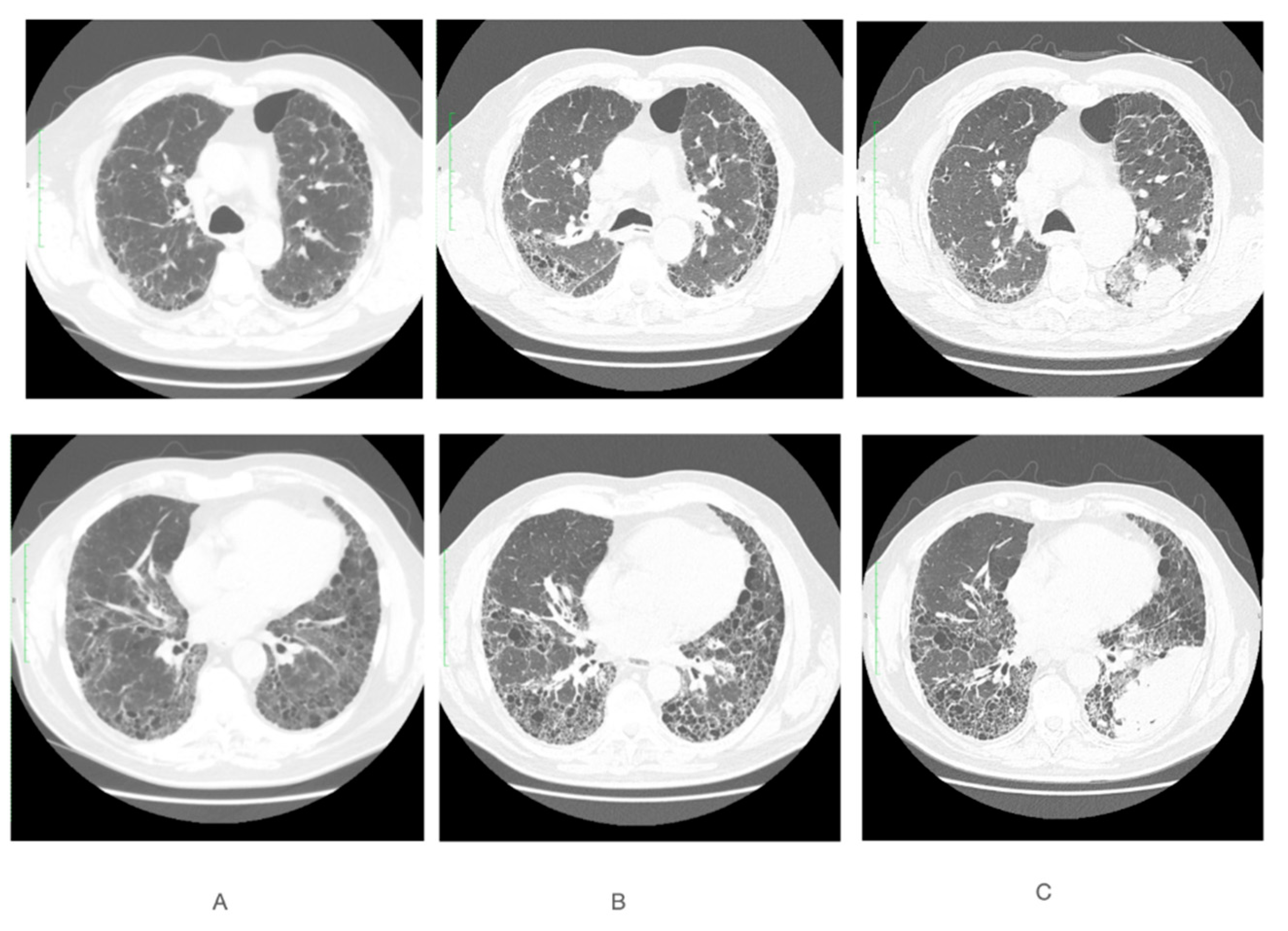 Curroncol 29 00401 g001 Curroncol 29 00401 g001