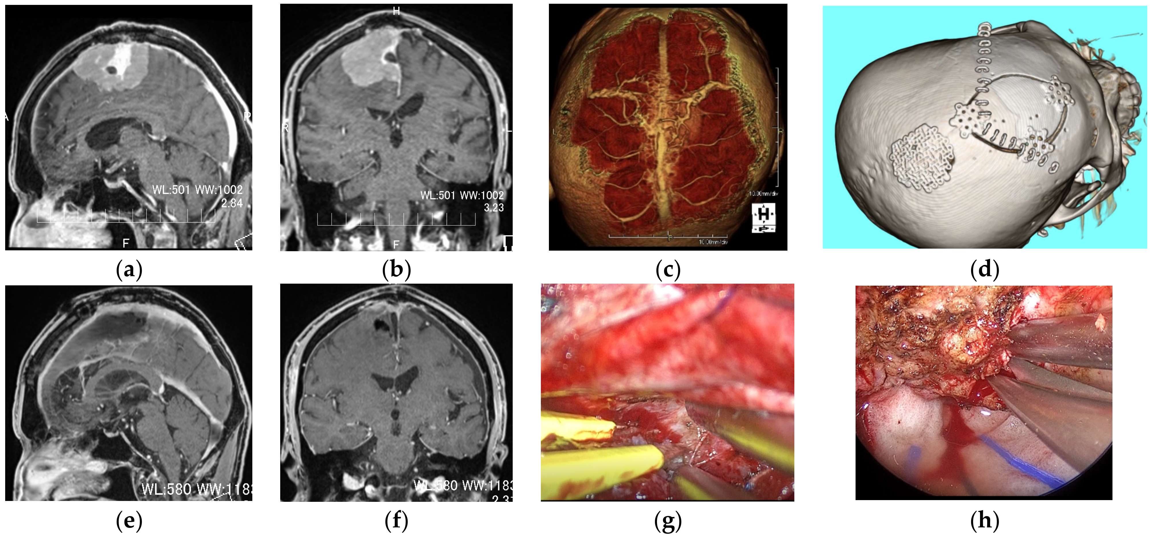 Curroncol 29 00426 g005 550