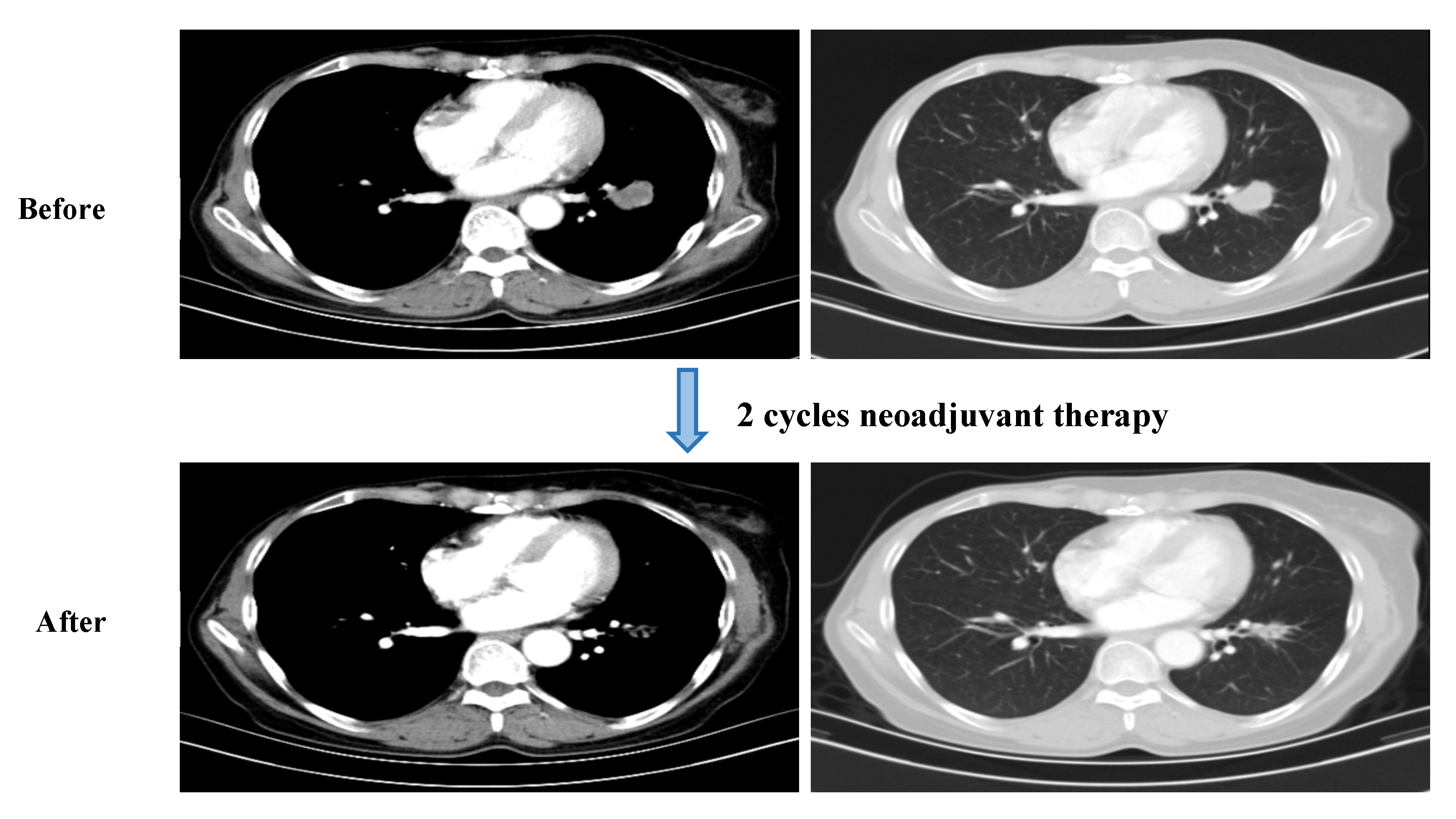 Curroncol 29 00487 g001 Curroncol 29 00487 g001