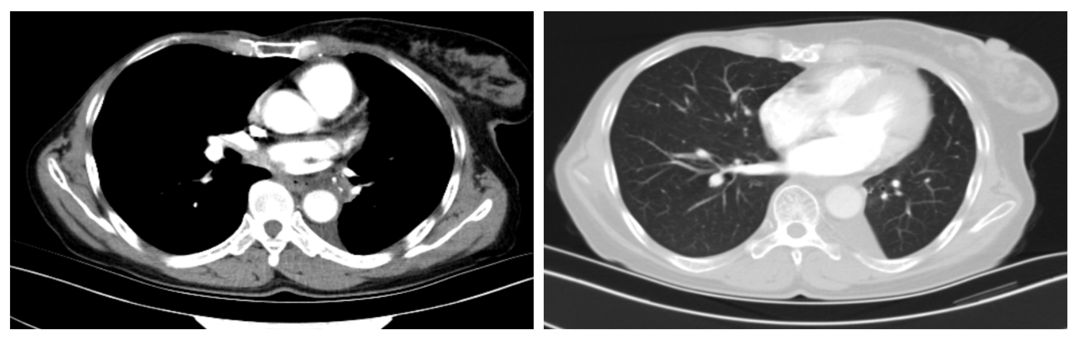 Curroncol 29 00487 g004 Curroncol 29 00487 g004