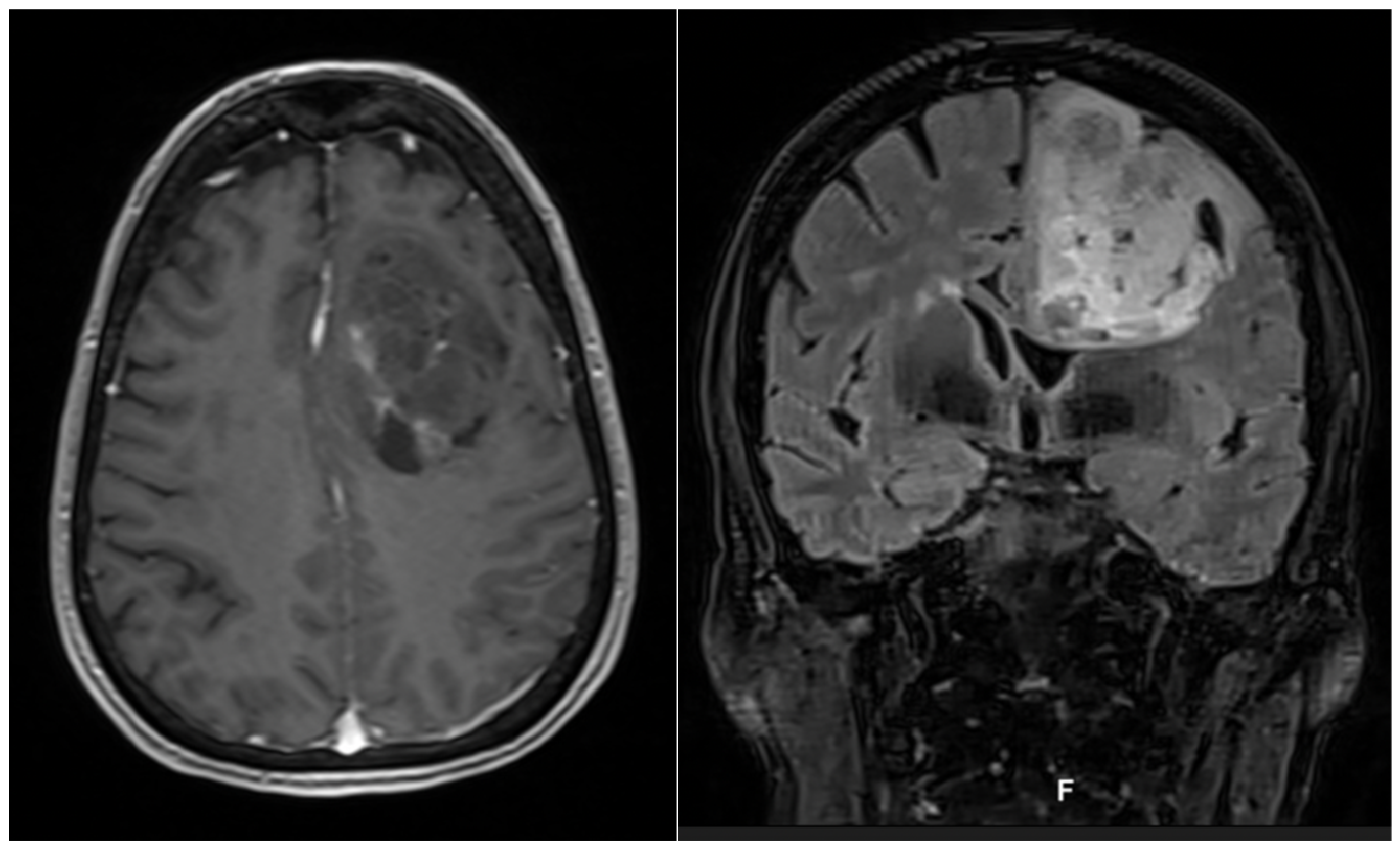 Curroncol 29 00518 g007