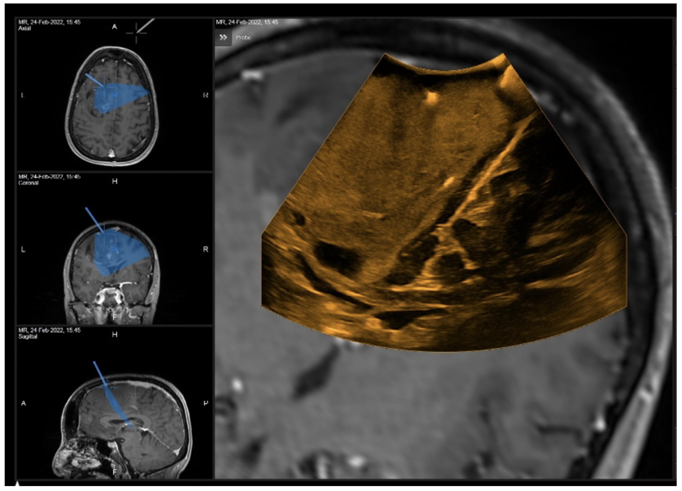 Curroncol 29 00518 g008