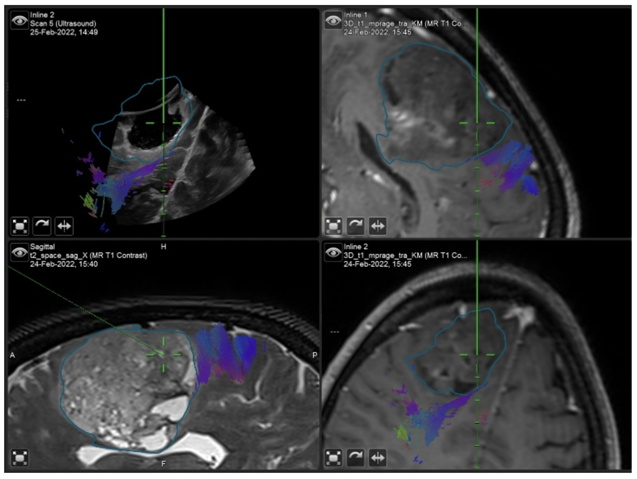 Curroncol 29 00518 g009