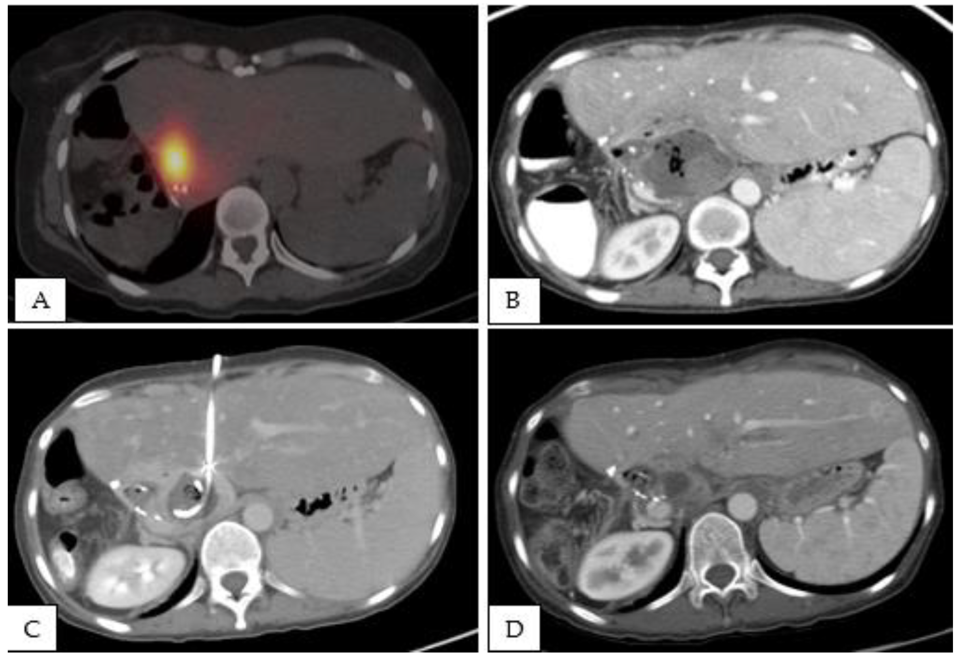 Curroncol 29 00553 g001 Curroncol 29 00553 g001