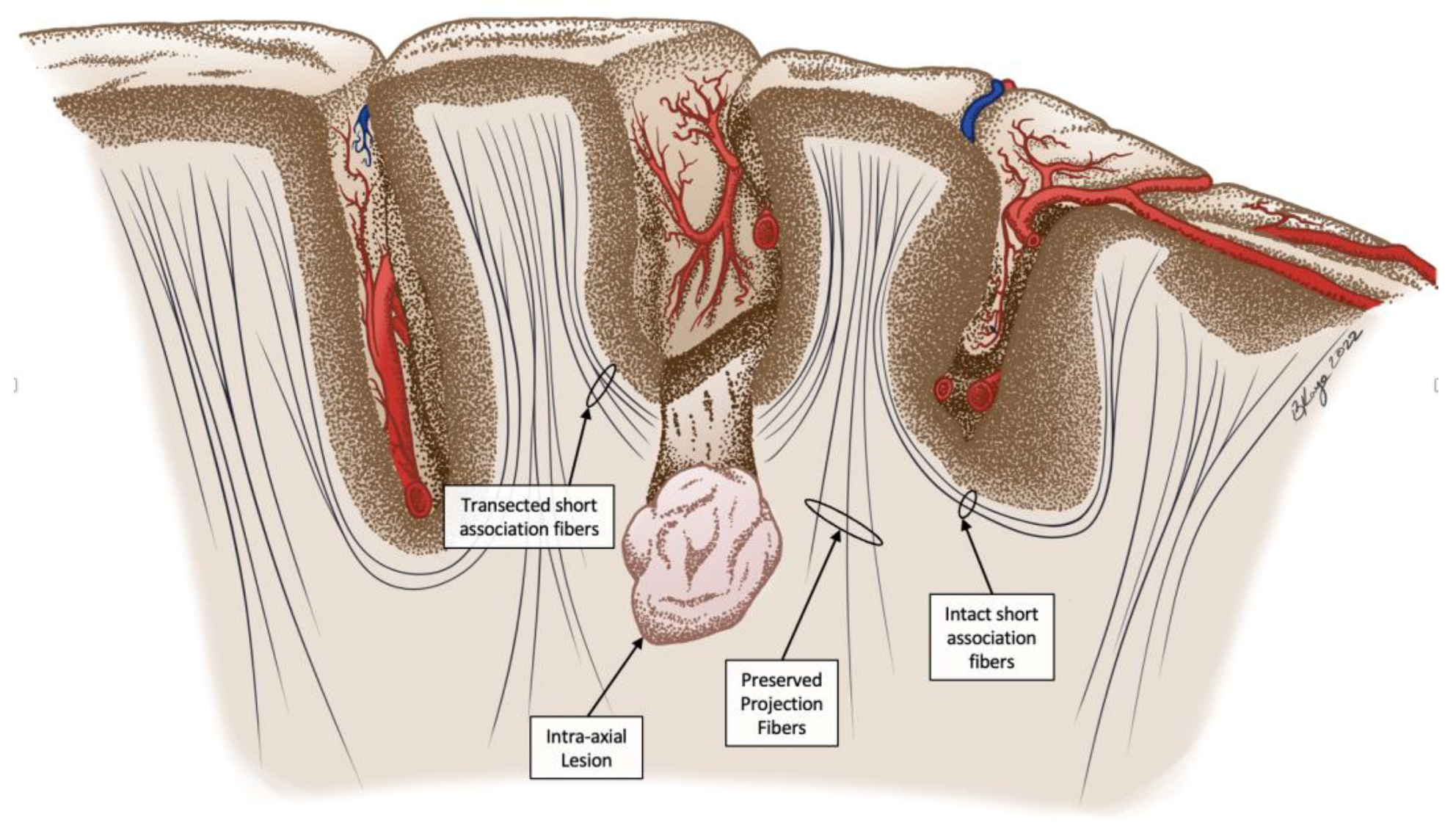 Curroncol 29 00581 g001 Curroncol 29 00581 g001