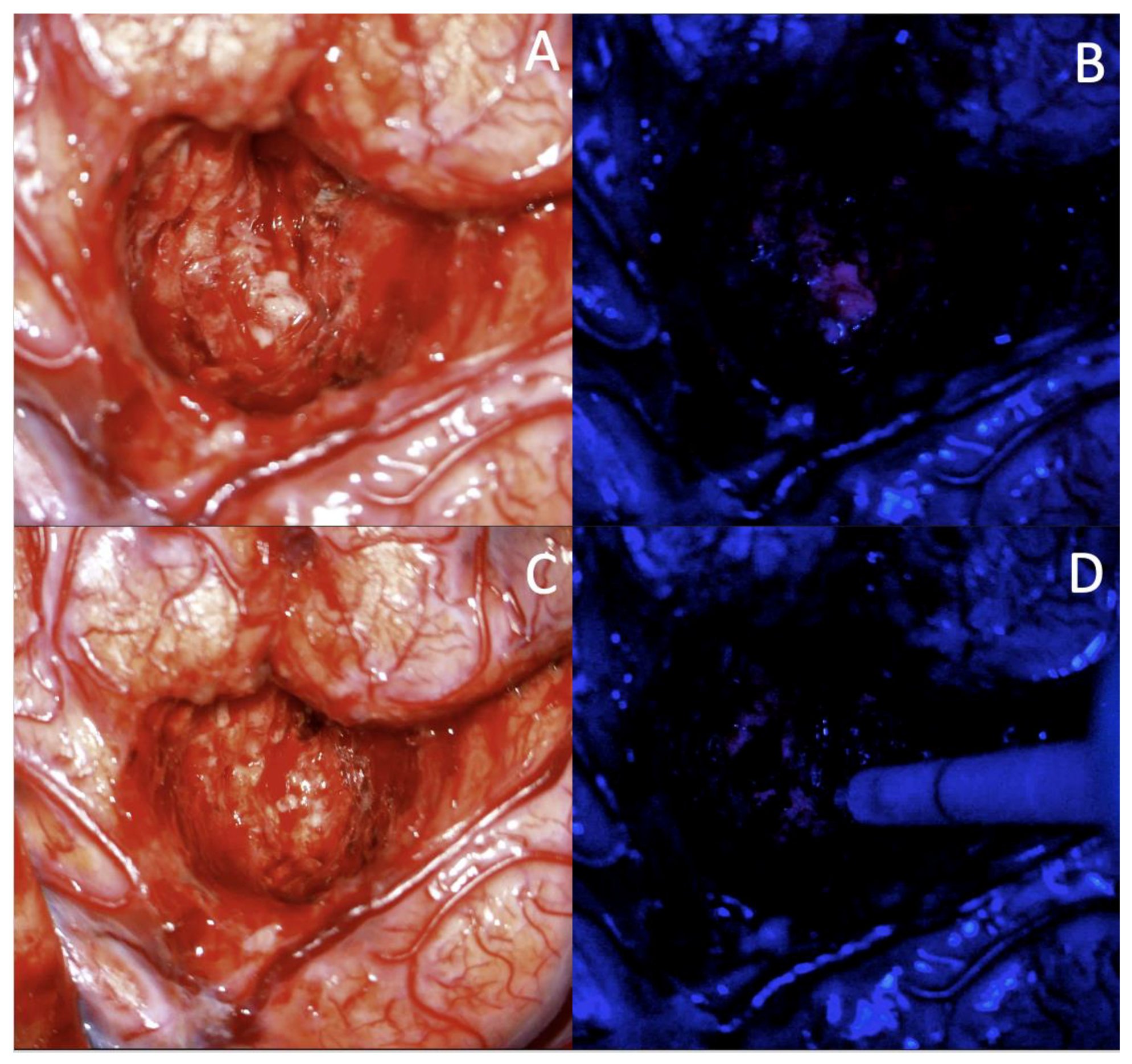 Curroncol 29 00581 g002 Curroncol 29 00581 g002