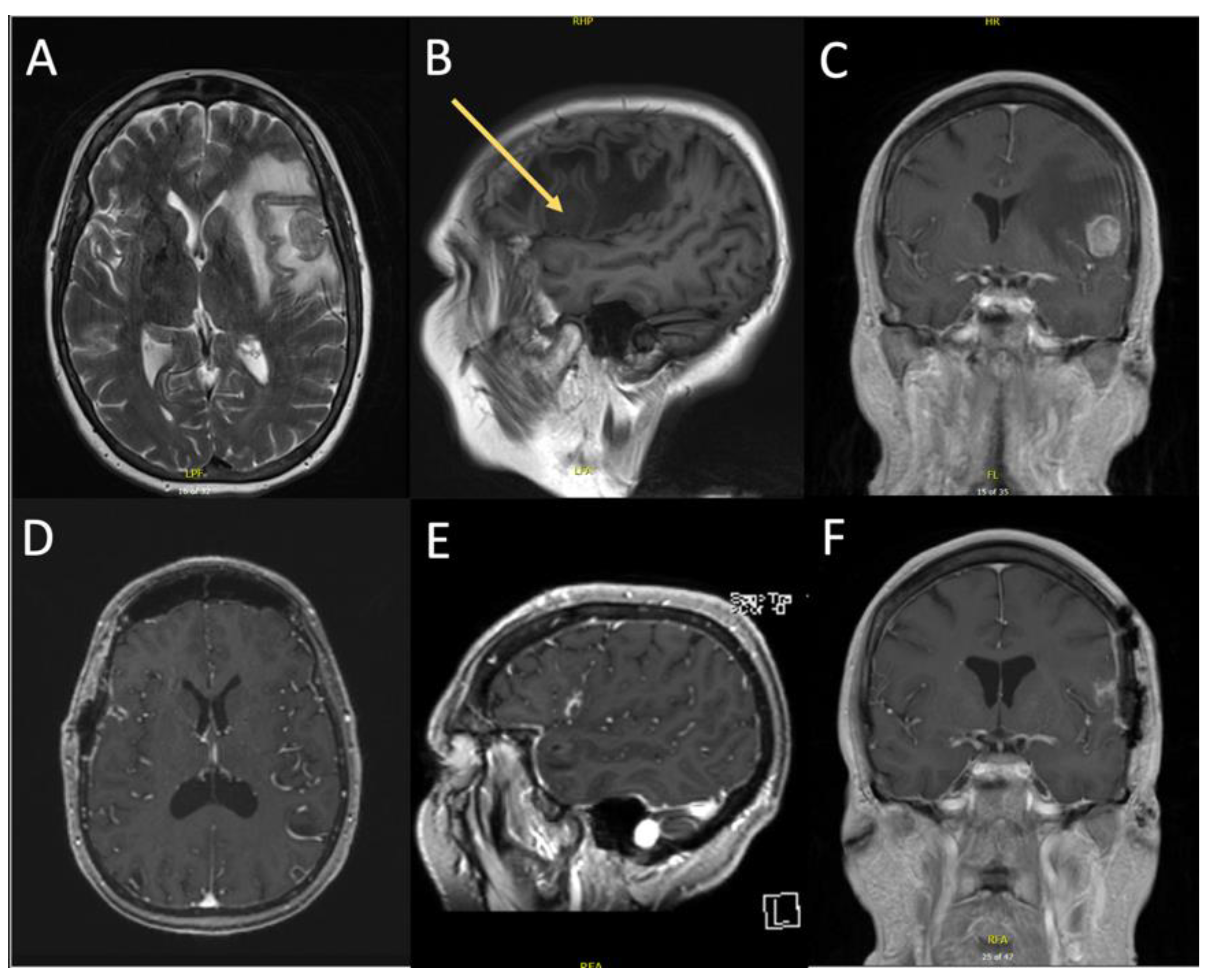 Curroncol 29 00581 g003 Curroncol 29 00581 g003
