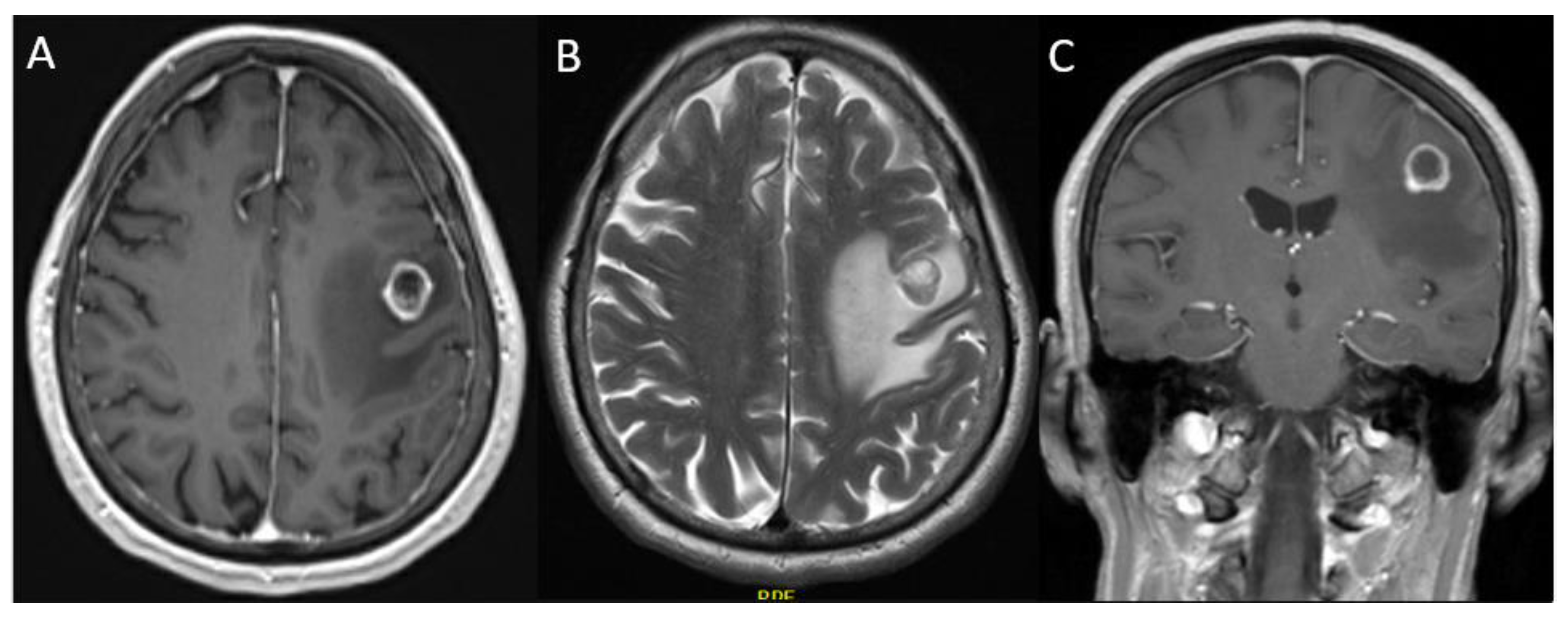 Curroncol 29 00581 g004 Curroncol 29 00581 g004