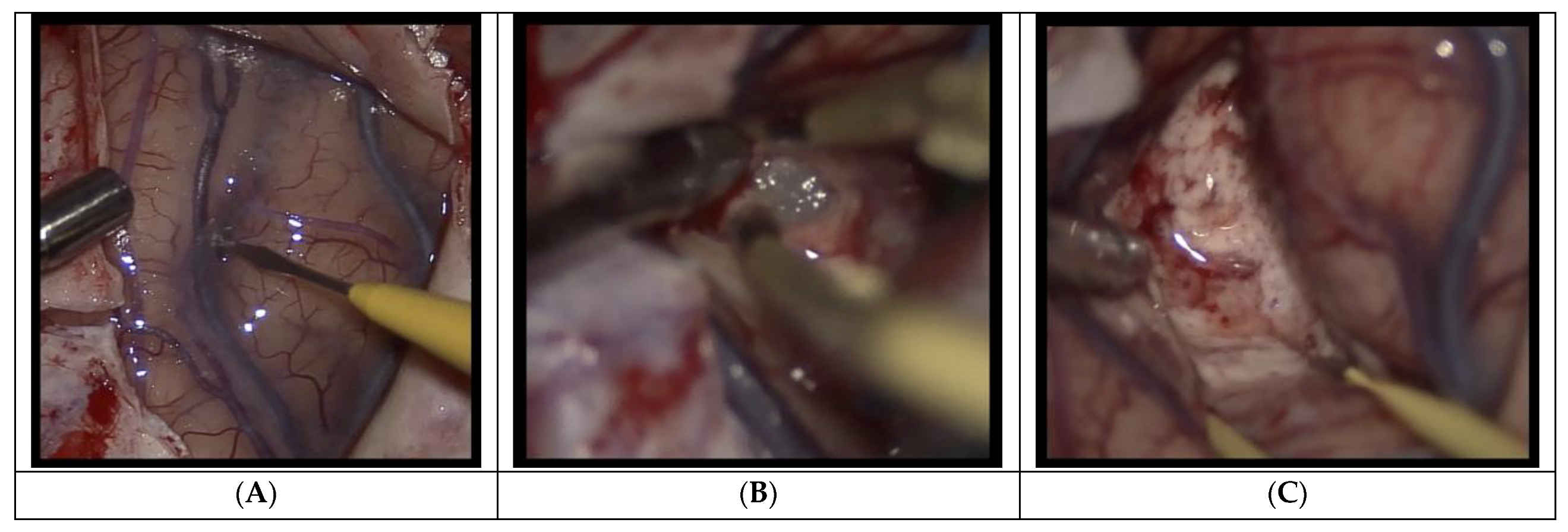 Curroncol 29 00581 g005 Curroncol 29 00581 g005