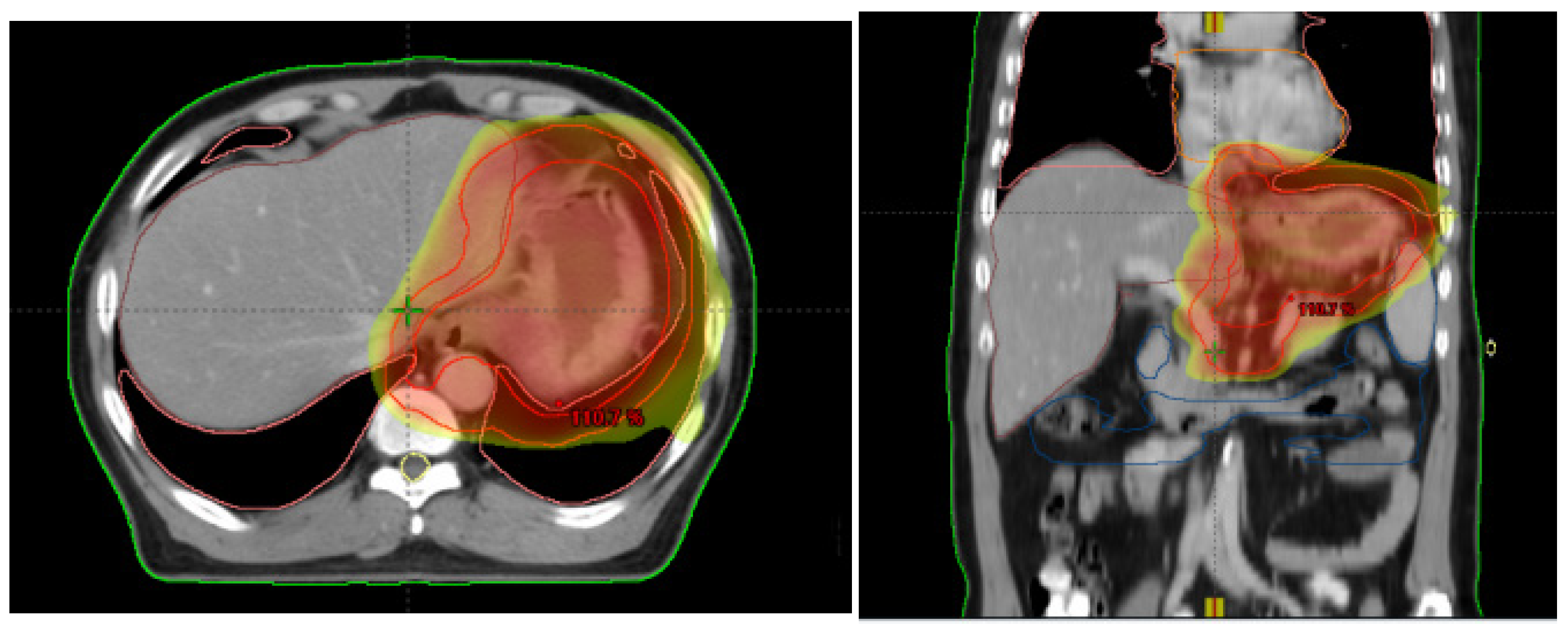 Curroncol 29 00586 g002