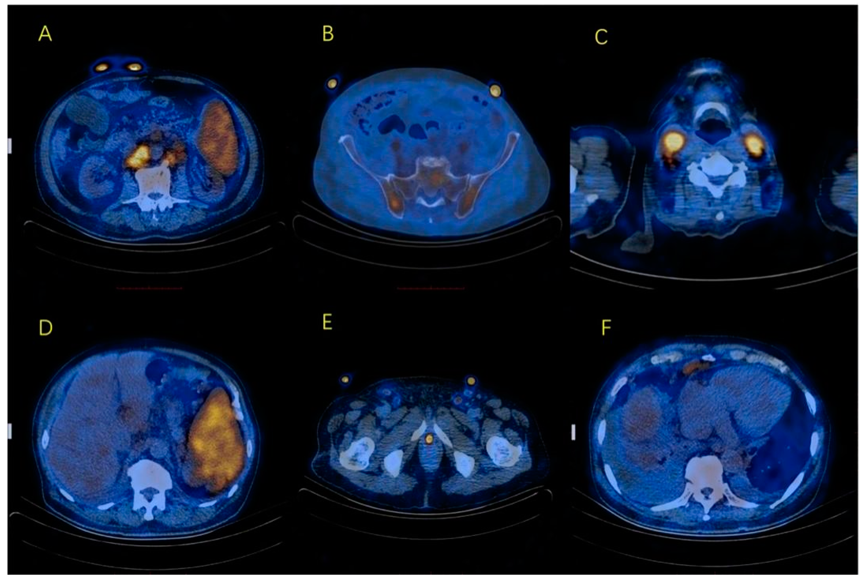 Curroncol 29 00603 g001 Curroncol 29 00603 g001