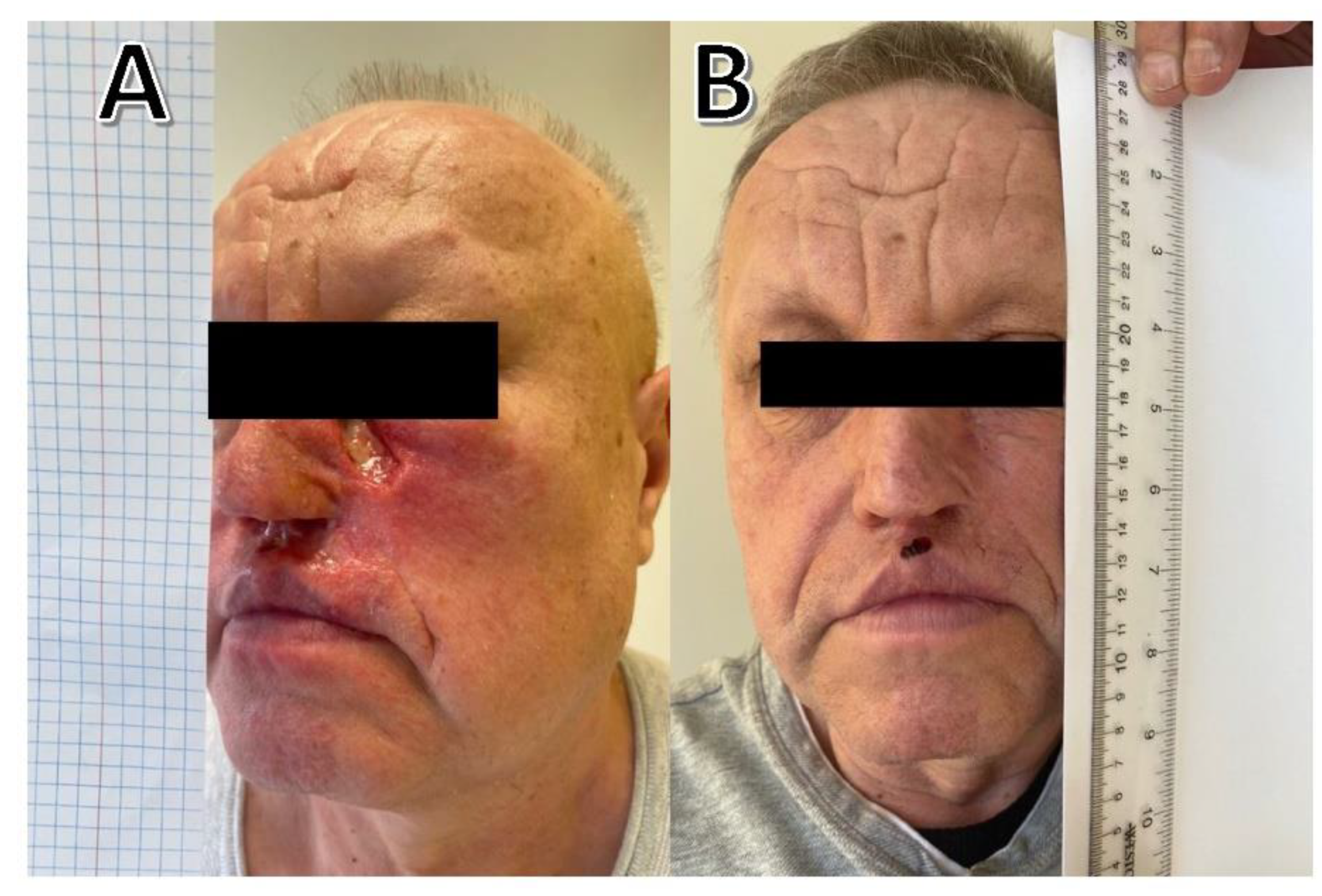 Curroncol 29 00616 g002 Curroncol 29 00616 g002