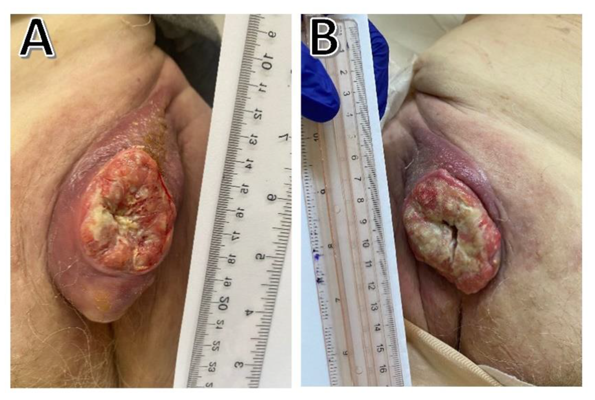 Curroncol 29 00616 g003 Curroncol 29 00616 g003