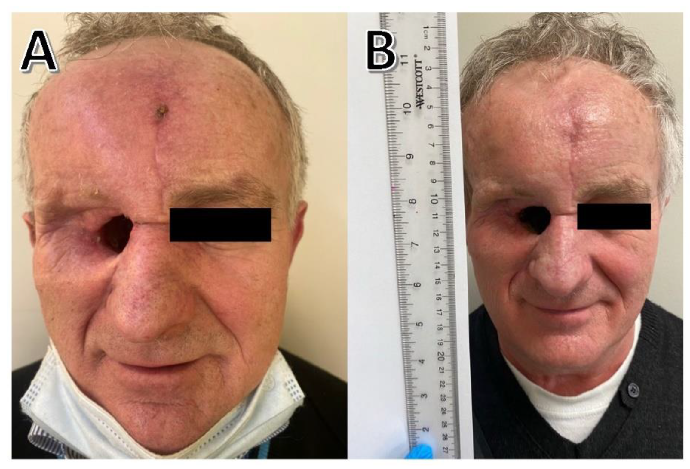 Curroncol 29 00616 g004 Curroncol 29 00616 g004