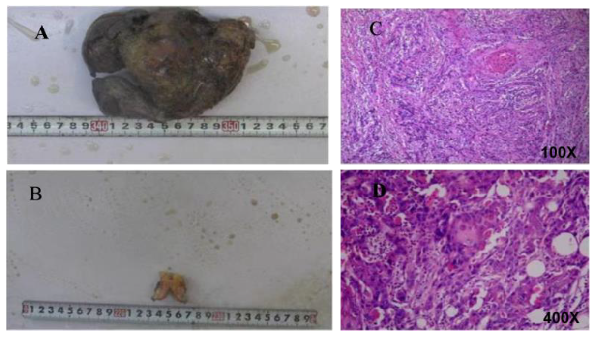 Curroncol 29 00632 g001 Curroncol 29 00632 g001