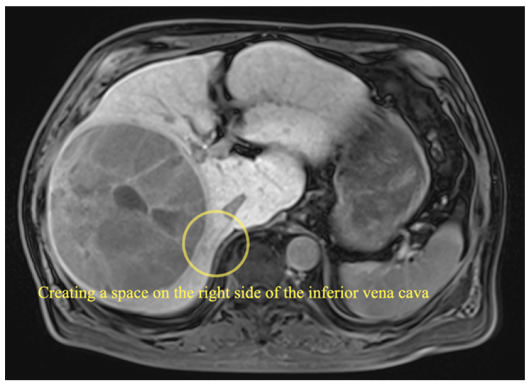 Curroncol 29 00652 g002 Curroncol 29 00652 g002