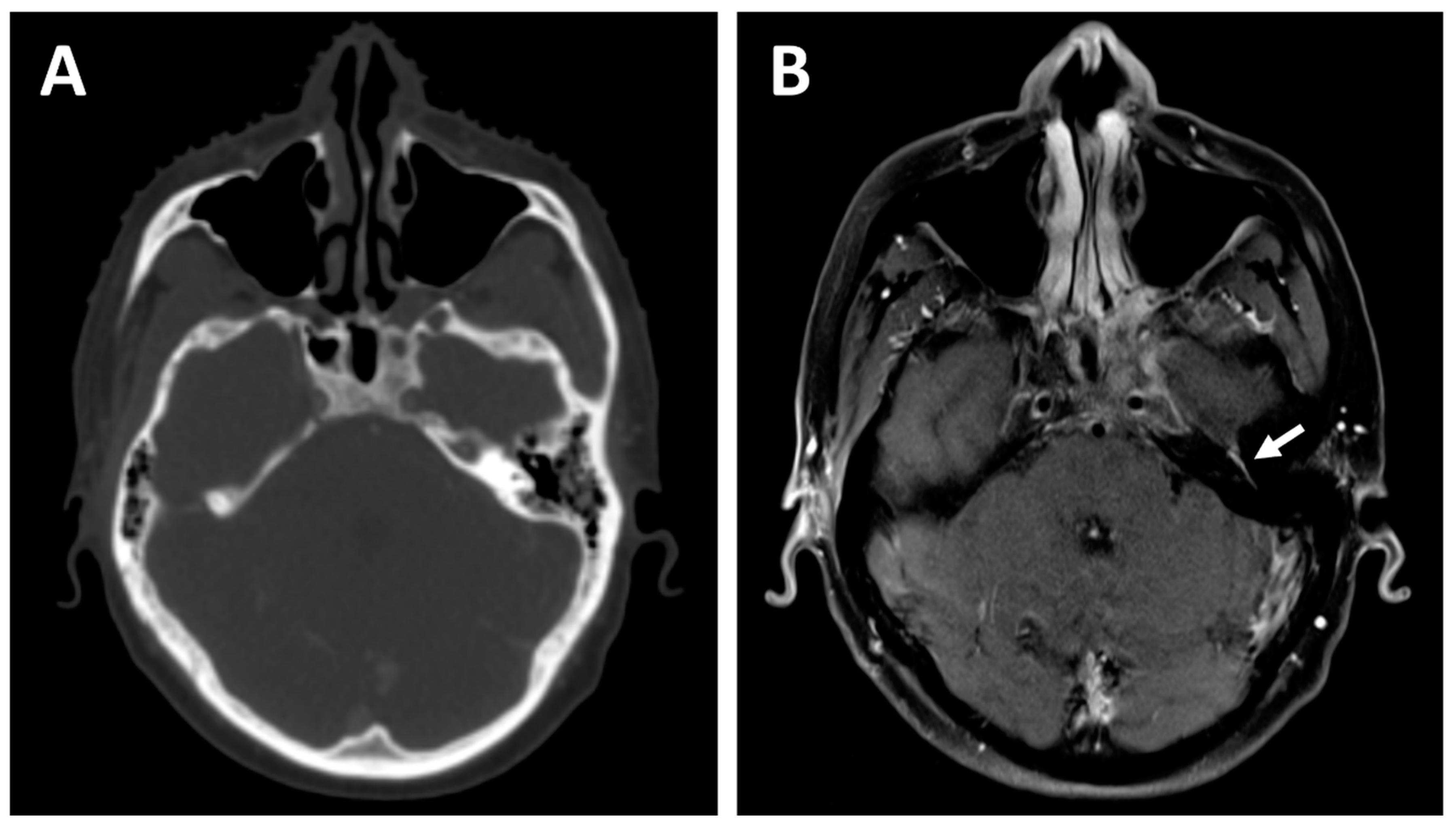 Magnetic Resonance of Myelination and Myelin Disorders