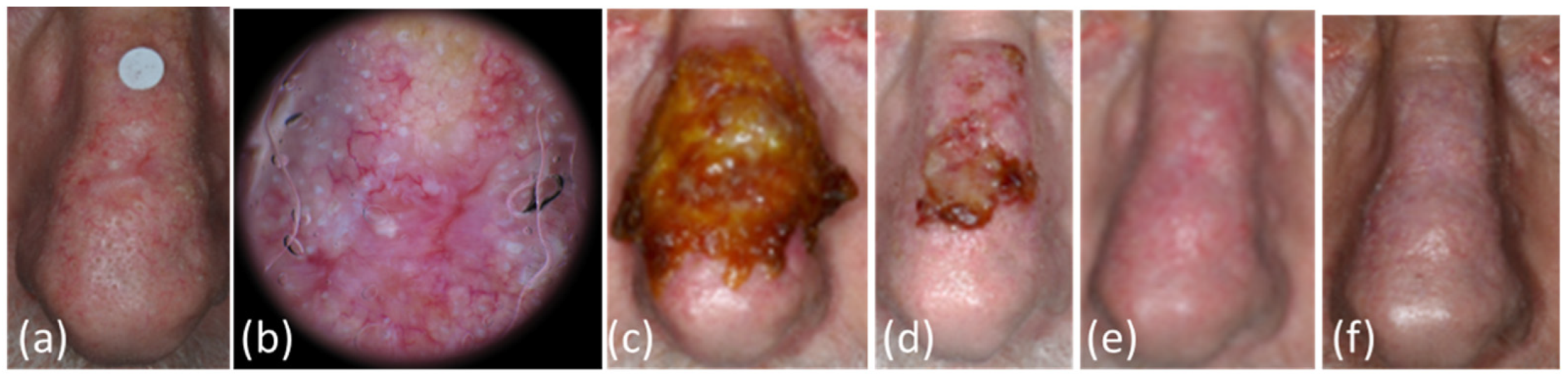 Curroncol 29 00668 g001