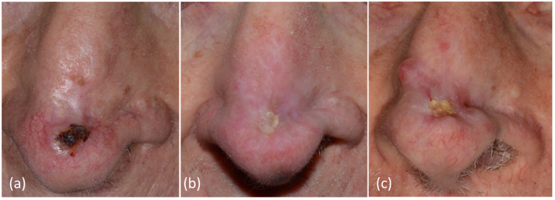 Curroncol 29 00668 g002