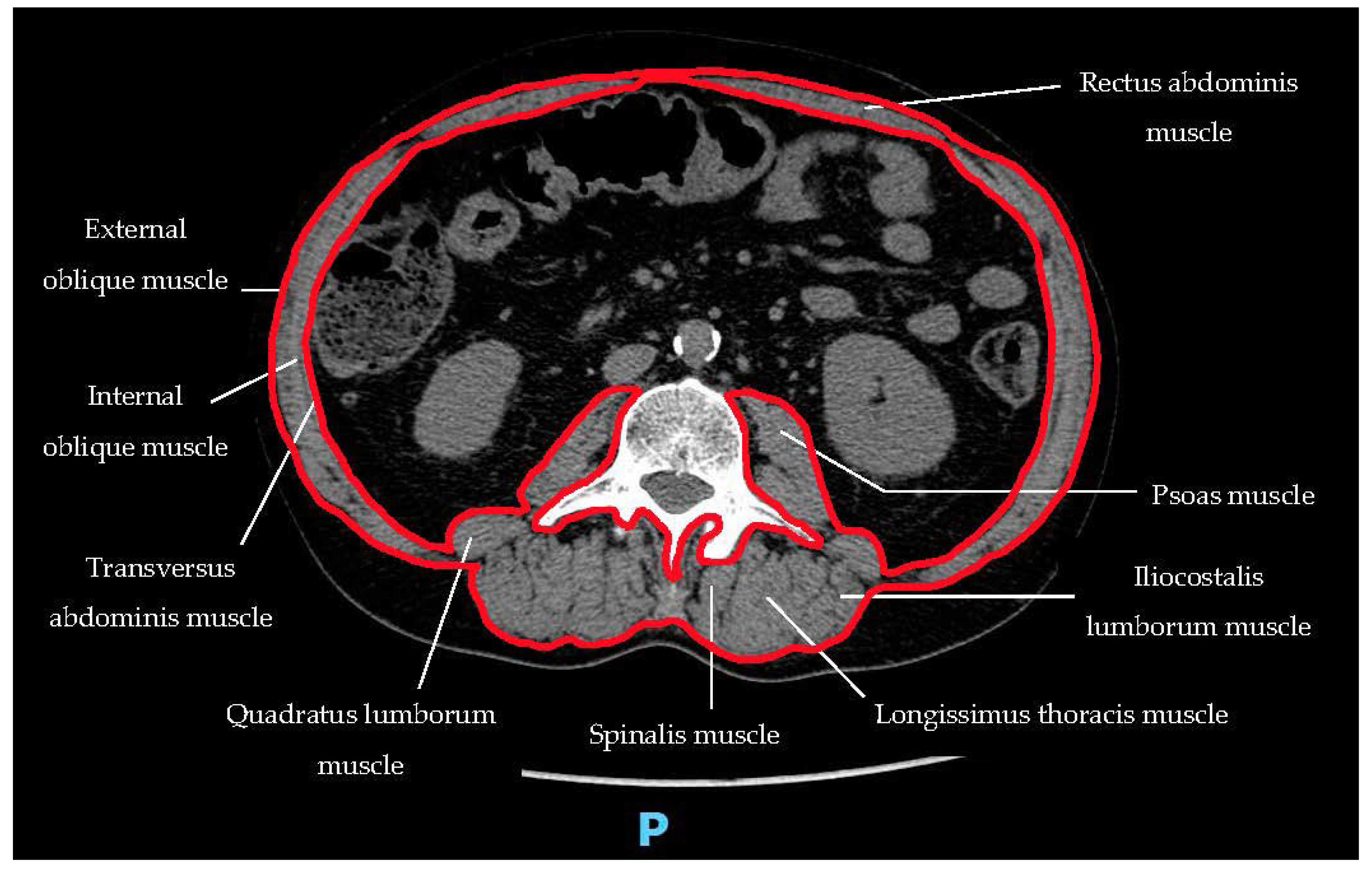 Curroncol 29 00671 g002 Curroncol 29 00671 g002