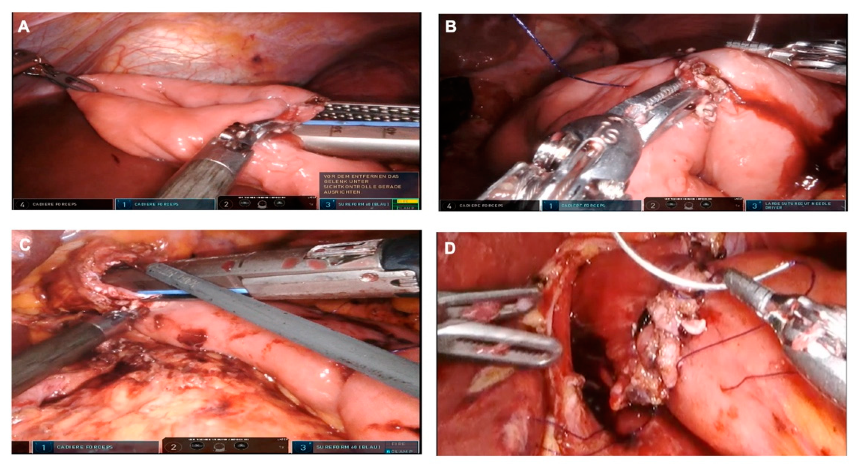 Curroncol 29 00678 g004 Curroncol 29 00678 g004
