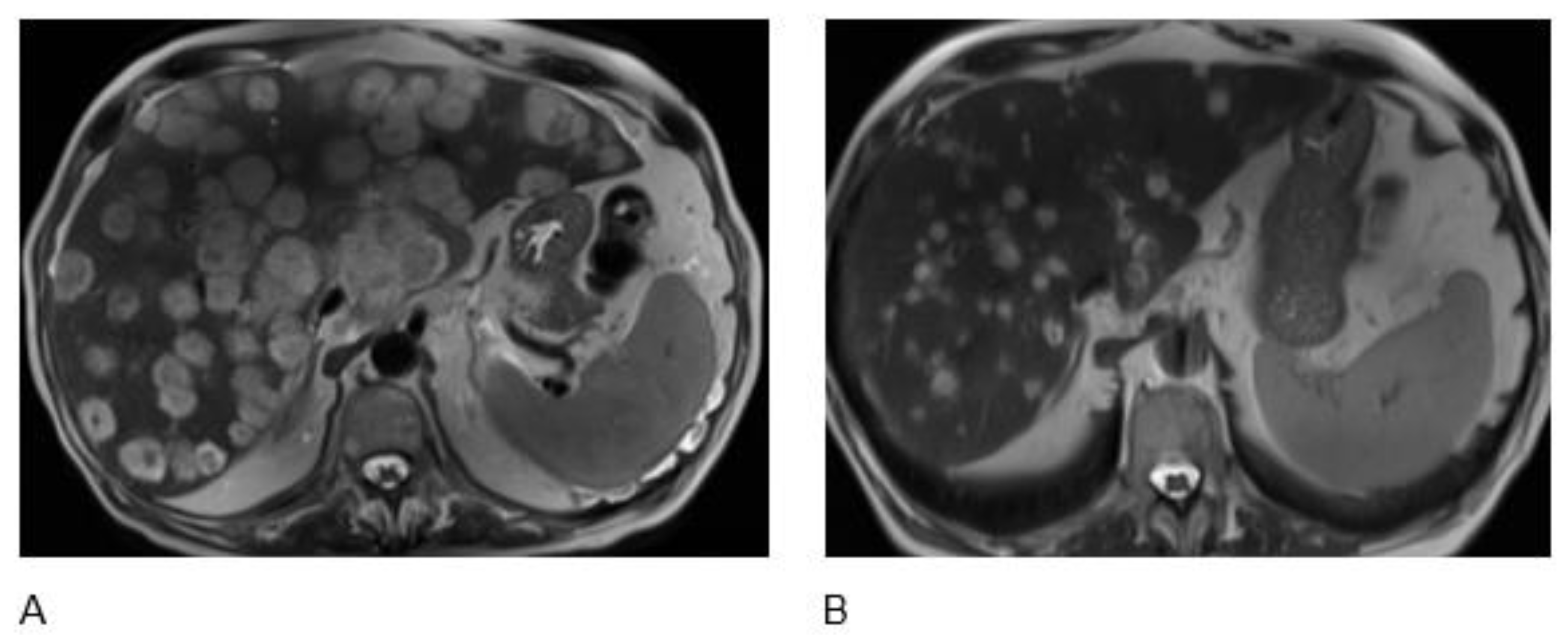 Curroncol 29 00707 g001 Curroncol 29 00707 g001