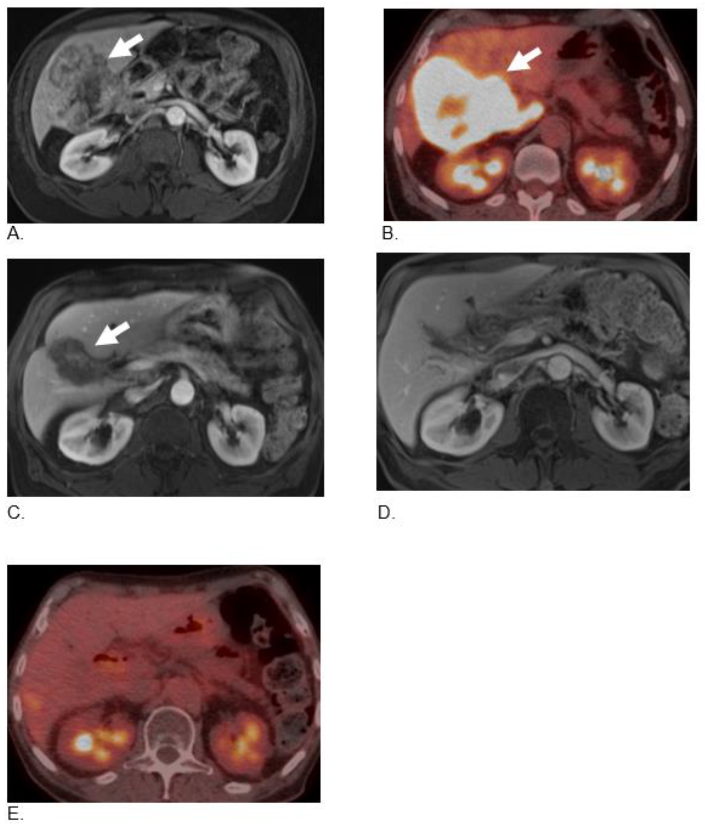Curroncol 29 00707 g002 Curroncol 29 00707 g002