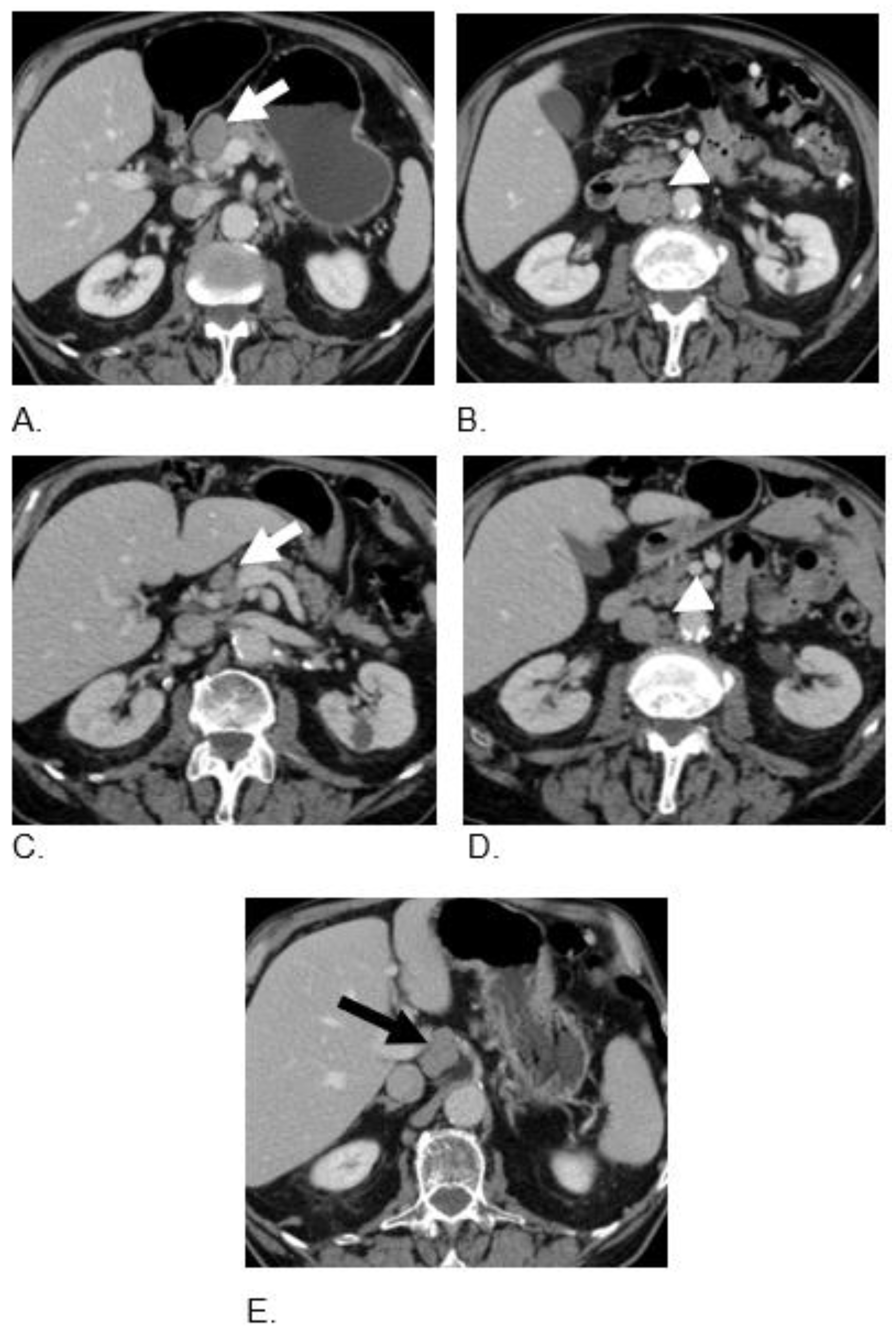 Curroncol 29 00707 g004 Curroncol 29 00707 g004