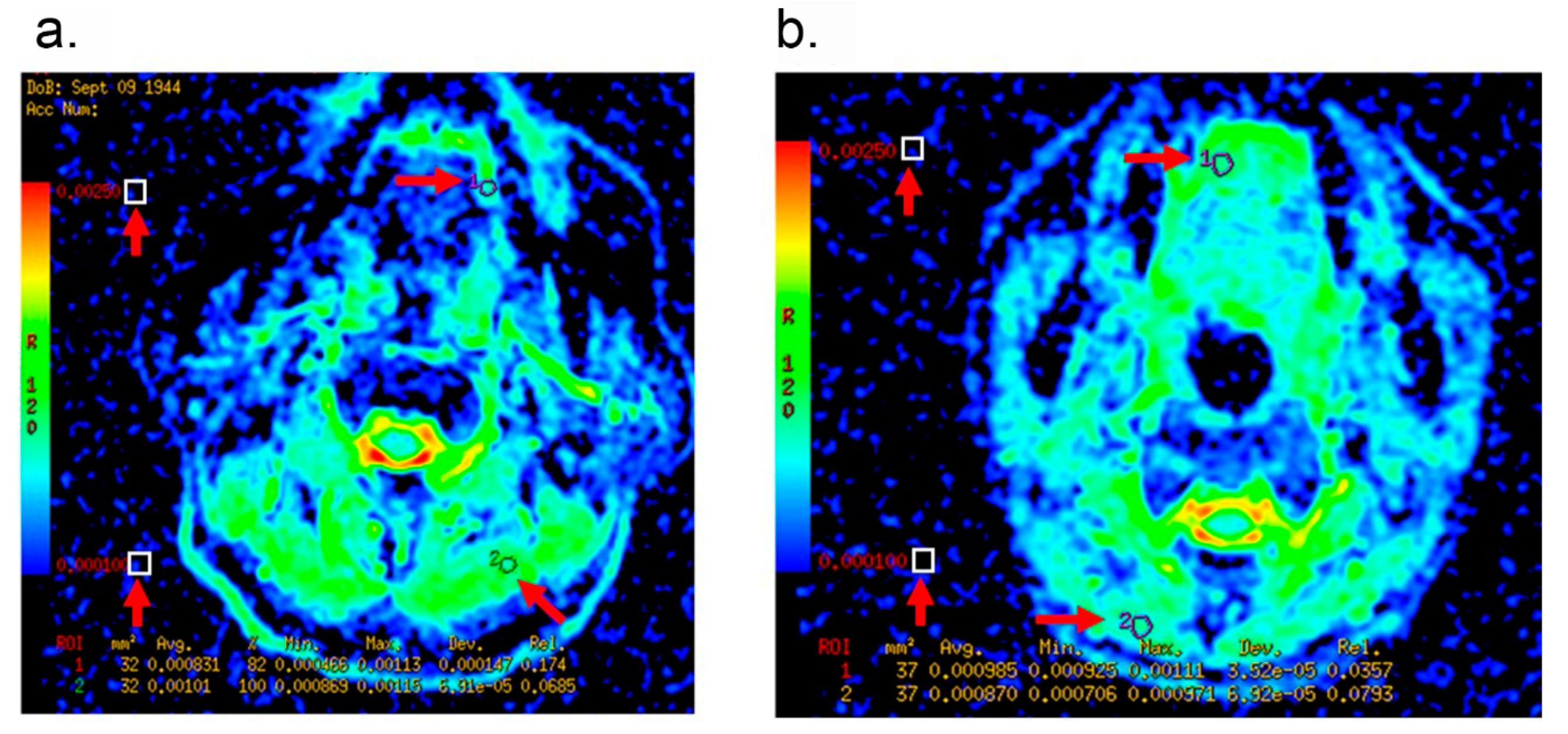 Curroncol 29 00708 g002 Curroncol 29 00708 g002
