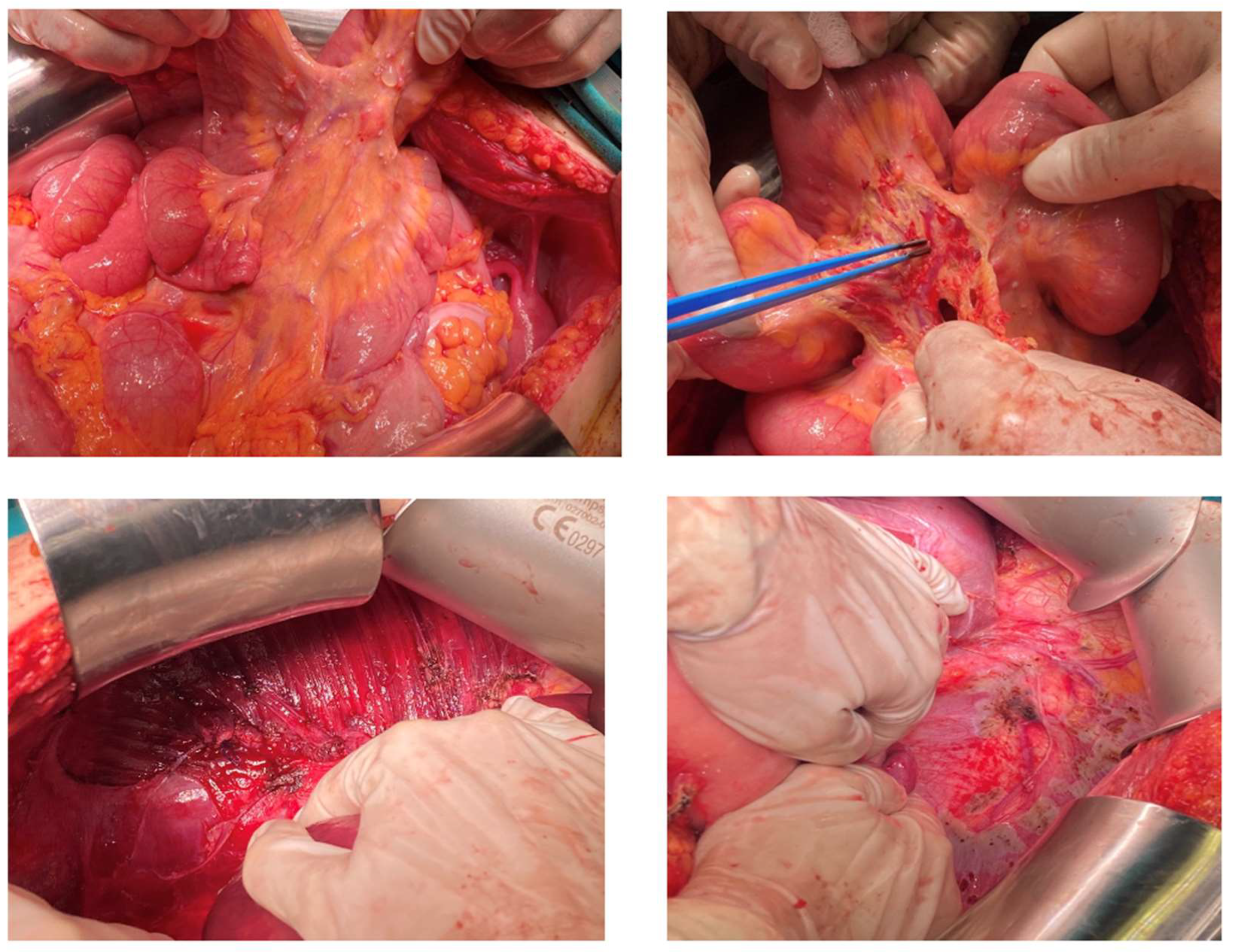 Curroncol 29 00712 g002 Curroncol 29 00712 g002