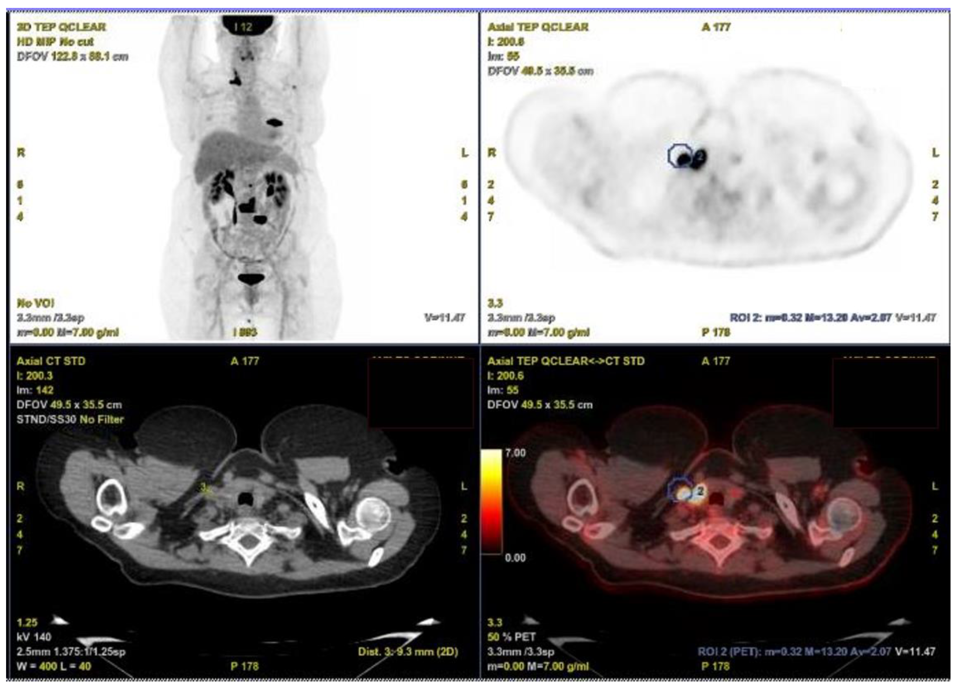 Curroncol 29 00723 g001 Curroncol 29 00723 g001