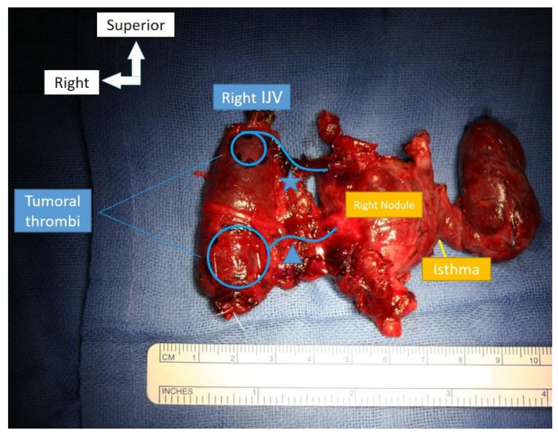 Curroncol 29 00723 g003 Curroncol 29 00723 g003