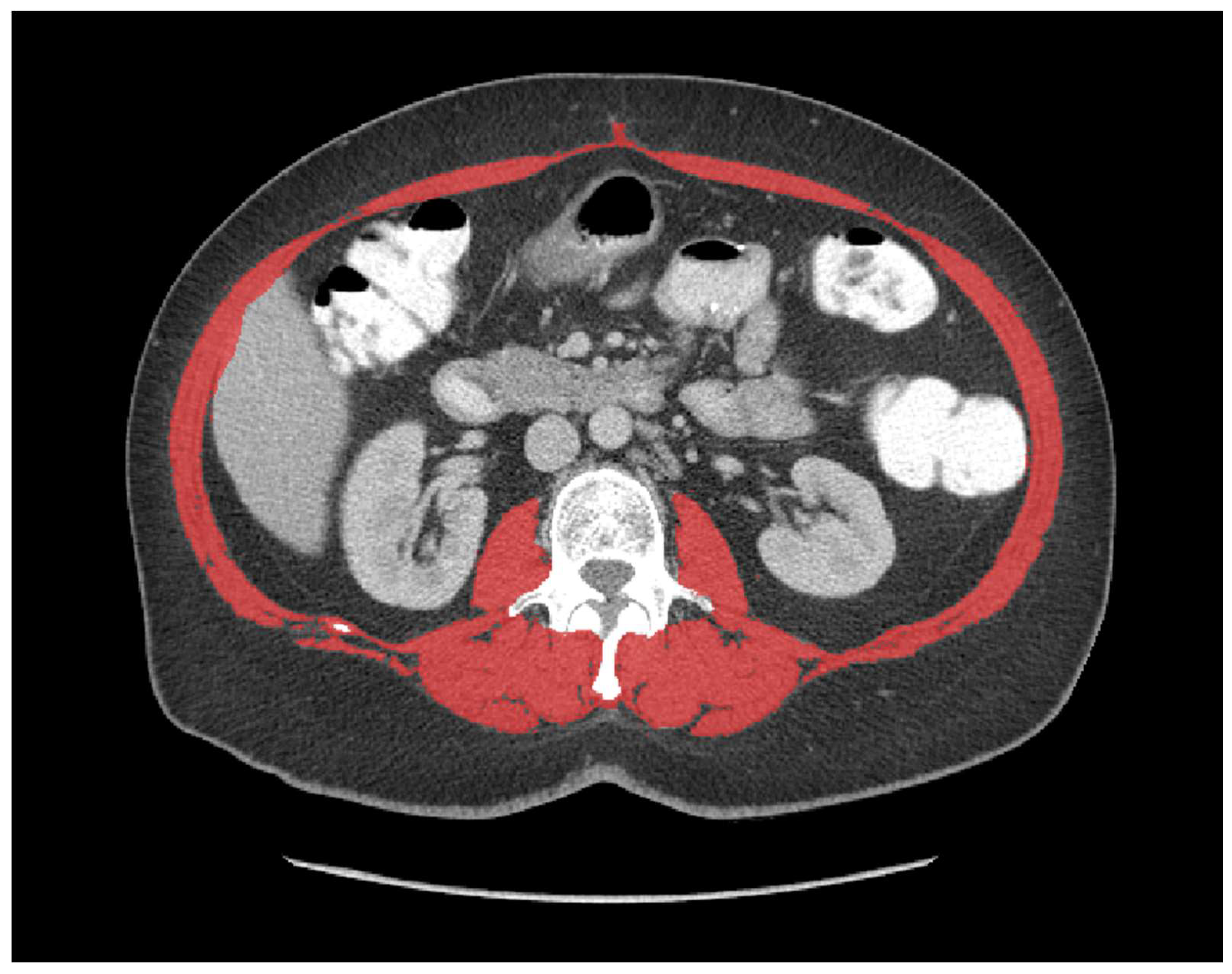 Curroncol 29 00730 g001 Curroncol 29 00730 g001